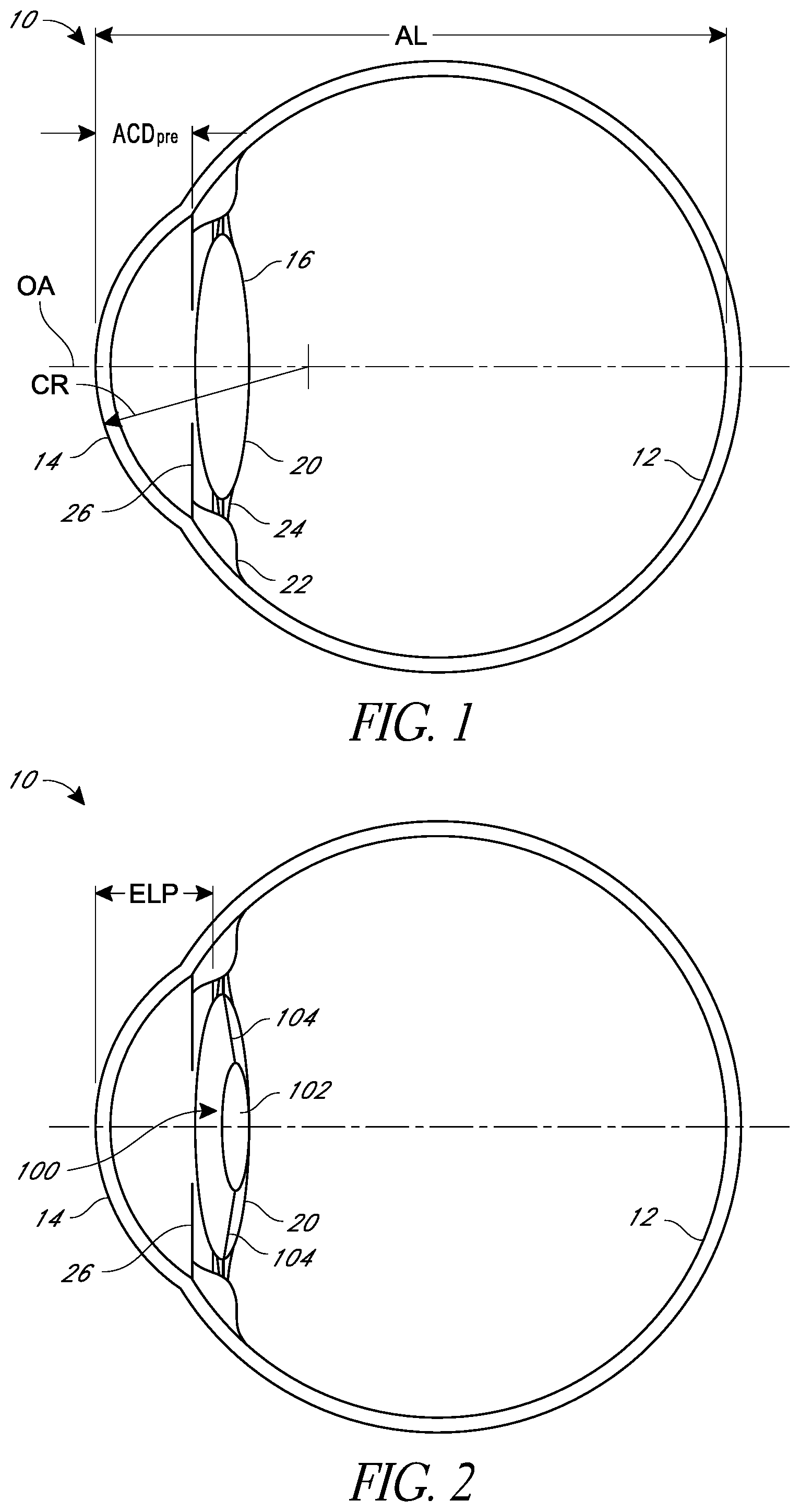 Patent US12472056 — Ophthalmic devices, system and methods that improve peripheral vision — Figure 1