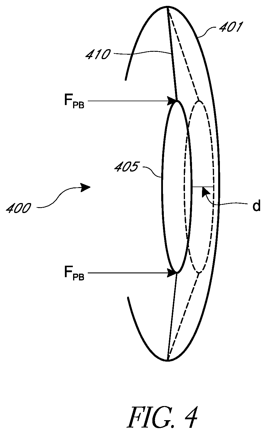 Patent US12472056 Figure 3 – Ophthalmic devices, system and methods that improve peripheral vision