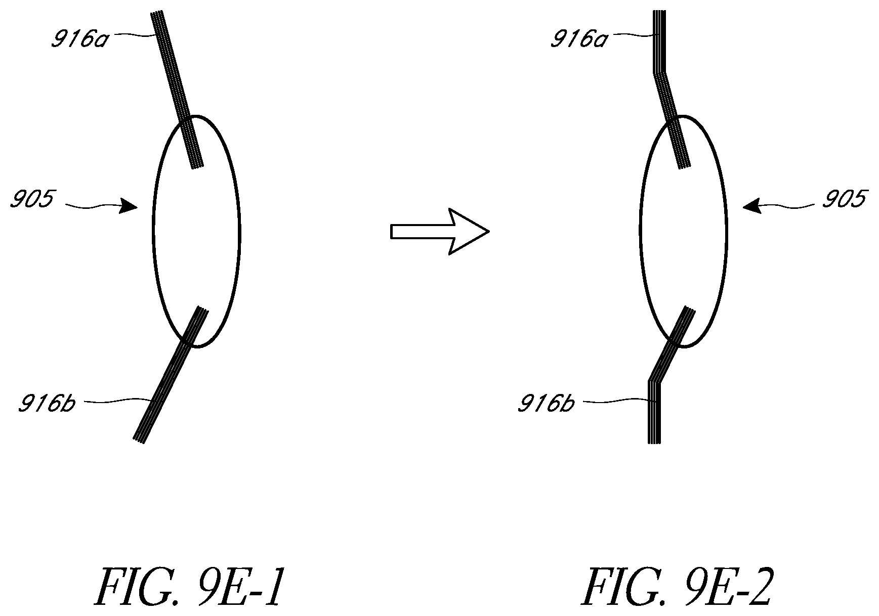 Patent US12472056 Figure 12 – Ophthalmic devices, system and methods that improve peripheral vision