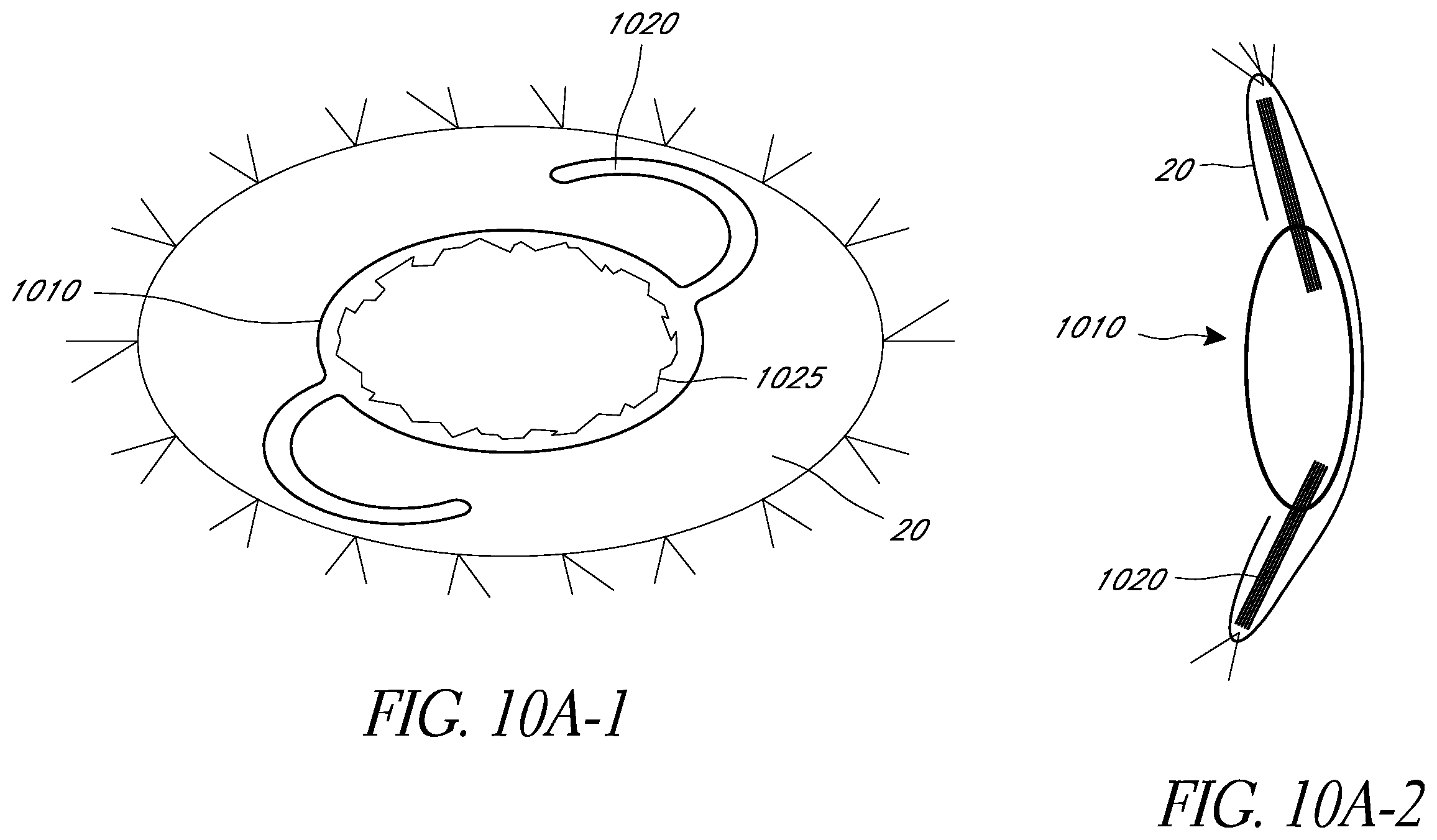 Patent US12472056 Figure 13 – Ophthalmic devices, system and methods that improve peripheral vision