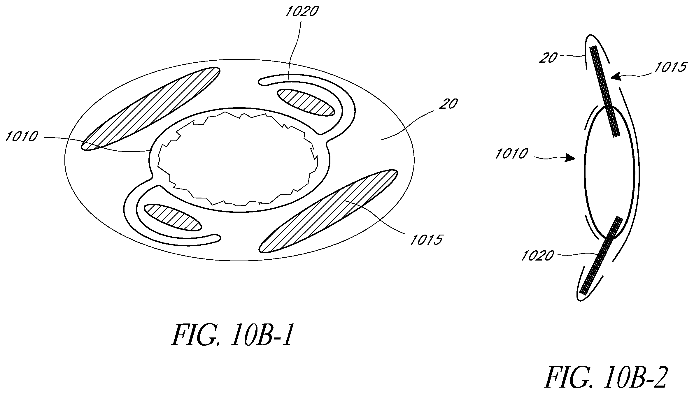 Patent US12472056 Figure 14 – Ophthalmic devices, system and methods that improve peripheral vision