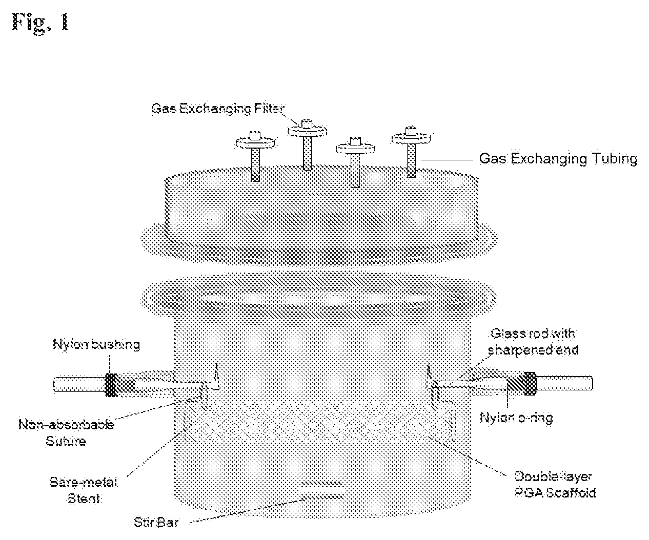 Patent US12472057 Figure 1 – Tubular prostheses