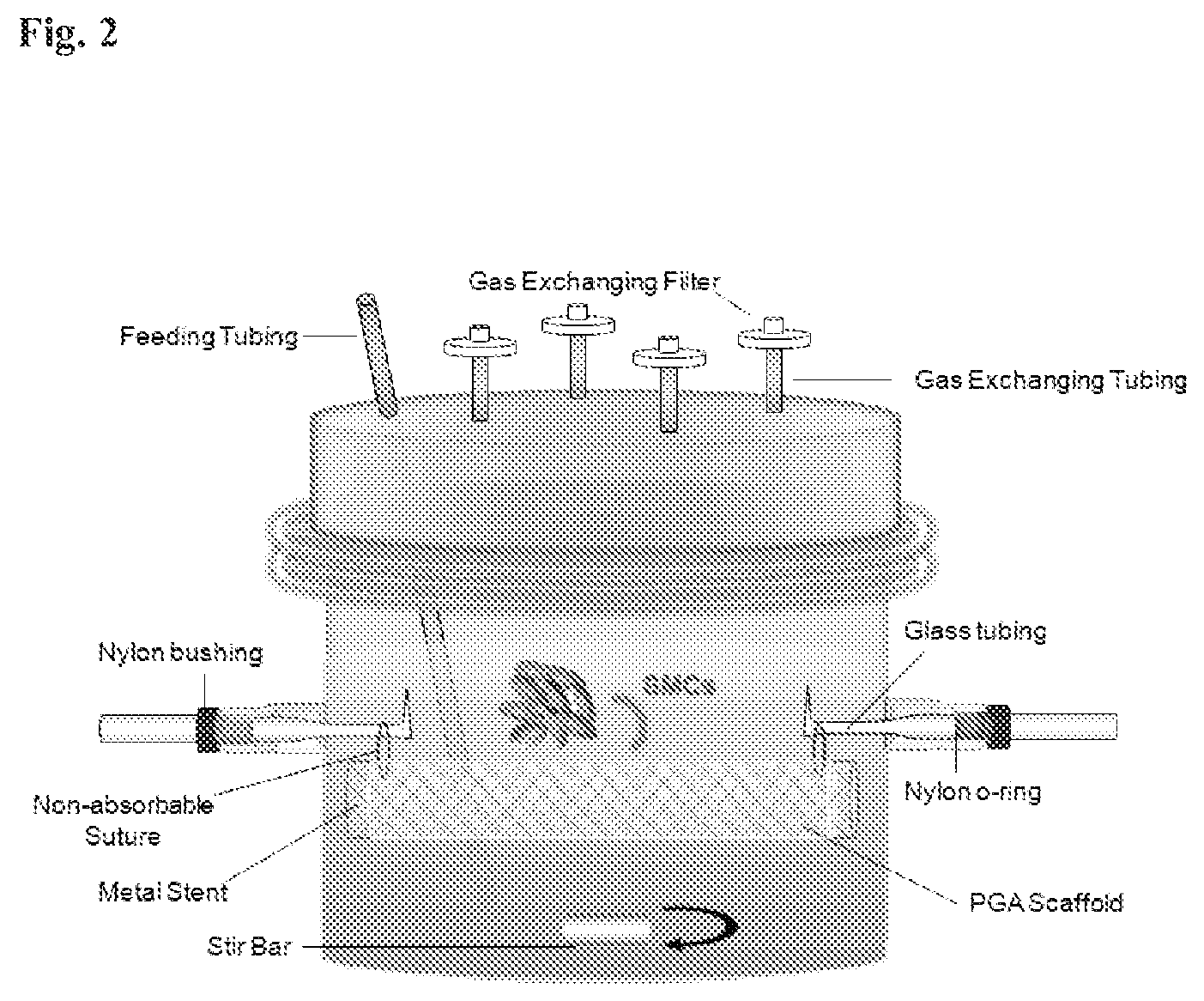 Patent US12472057 Figure 2 – Tubular prostheses