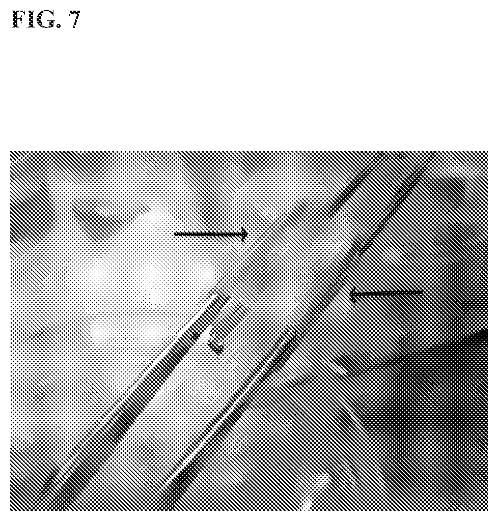 Patent US12472057 Figure 7 – Tubular prostheses