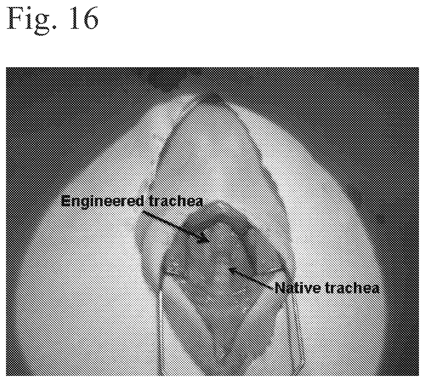 Patent US12472057 Figure 16 – Tubular prostheses