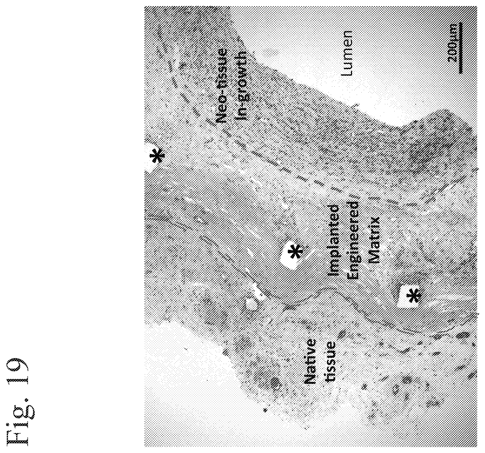 Patent US12472057 Figure 19 – Tubular prostheses