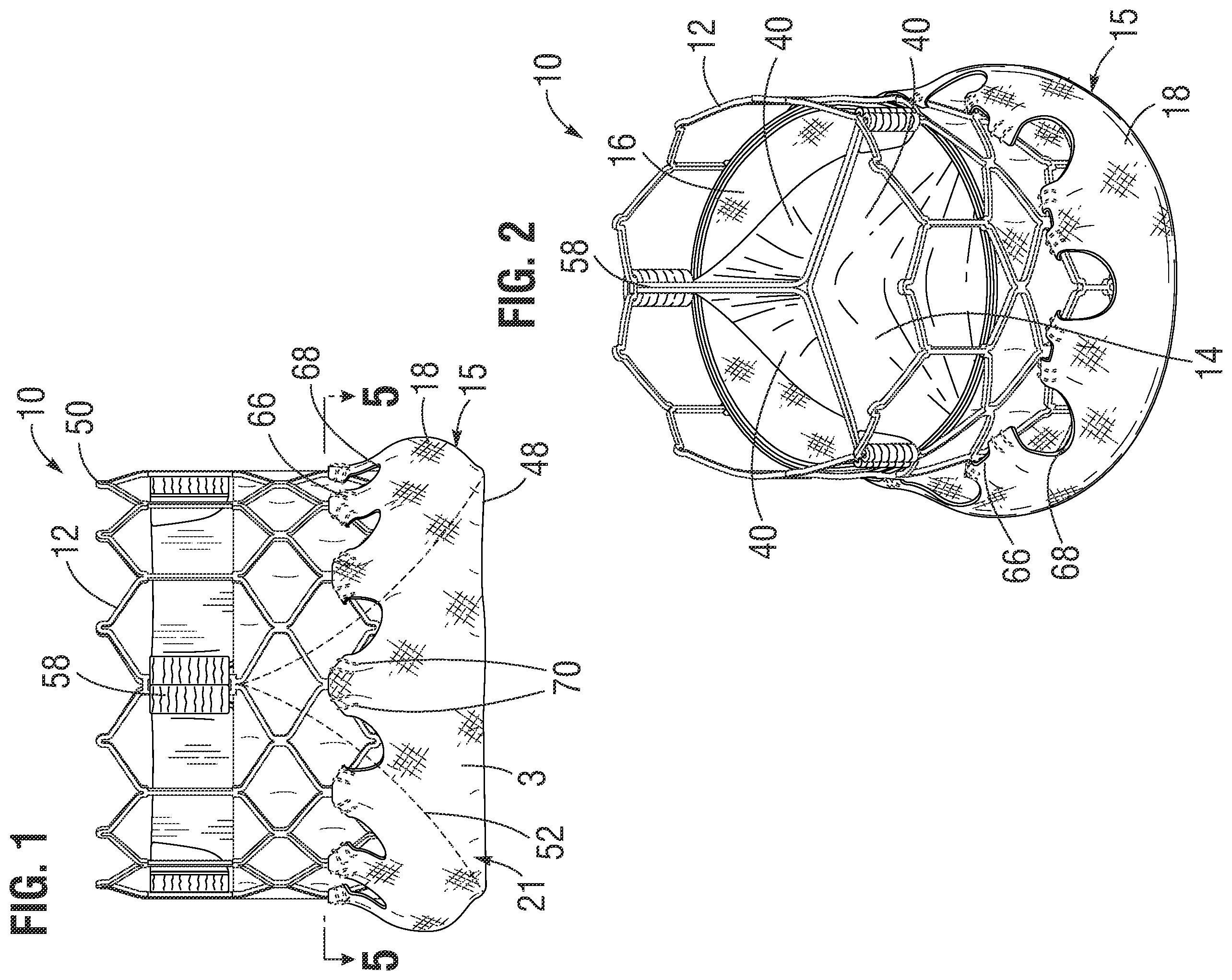Patent US12472058 Figure 1 – Skirt assembly for implantable prosthetic valve