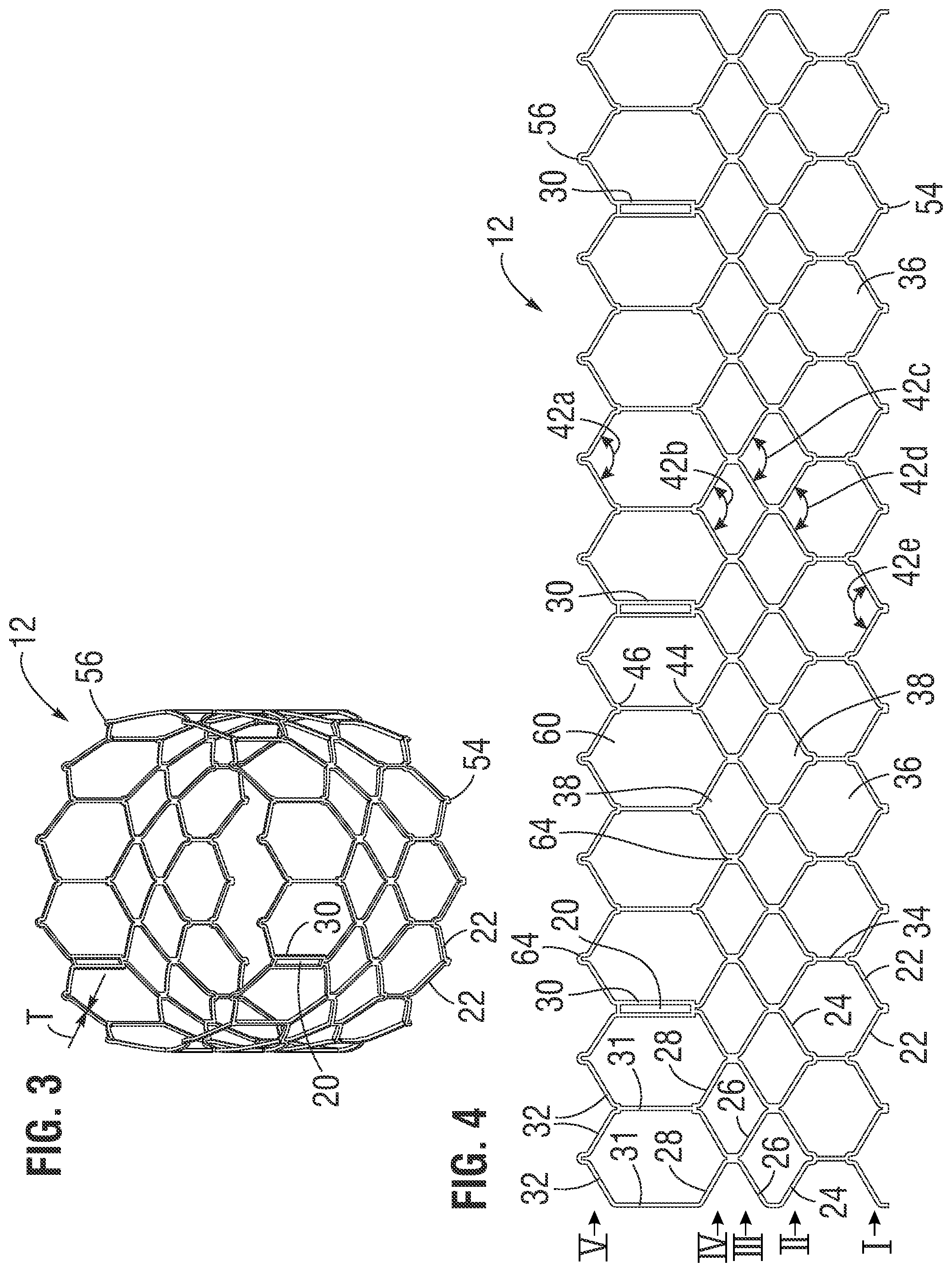 Patent US12472058 Figure 2 – Skirt assembly for implantable prosthetic valve