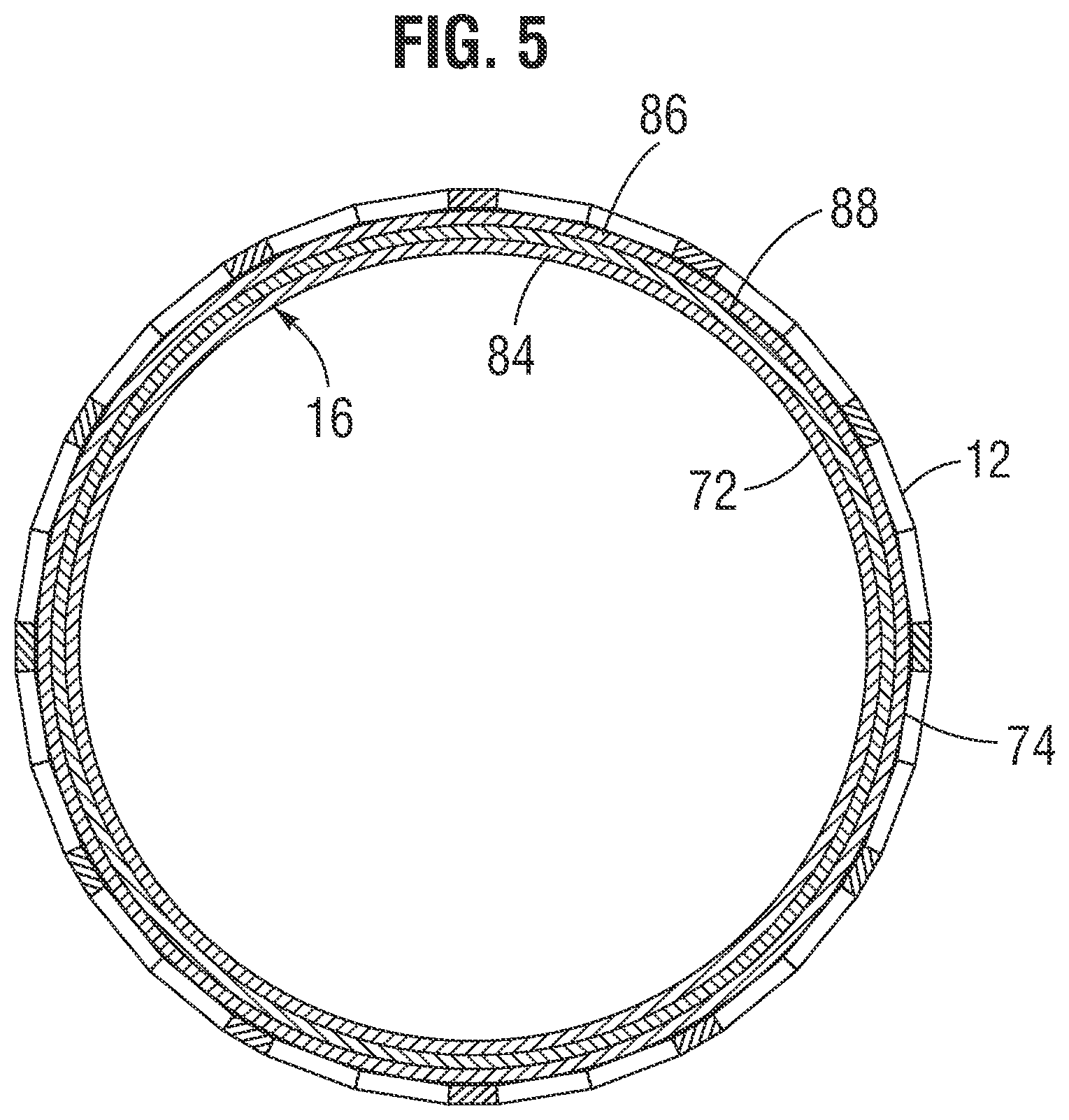 Patent US12472058 Figure 3 – Skirt assembly for implantable prosthetic valve