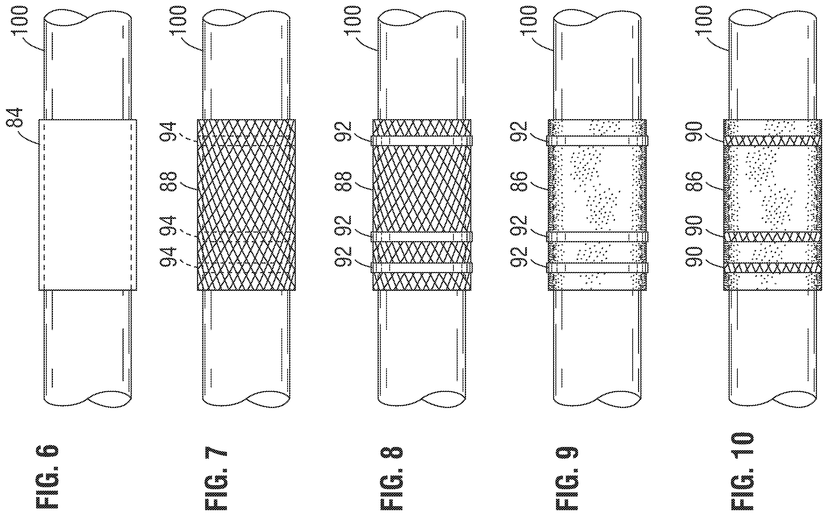 Patent US12472058 Figure 4 – Skirt assembly for implantable prosthetic valve