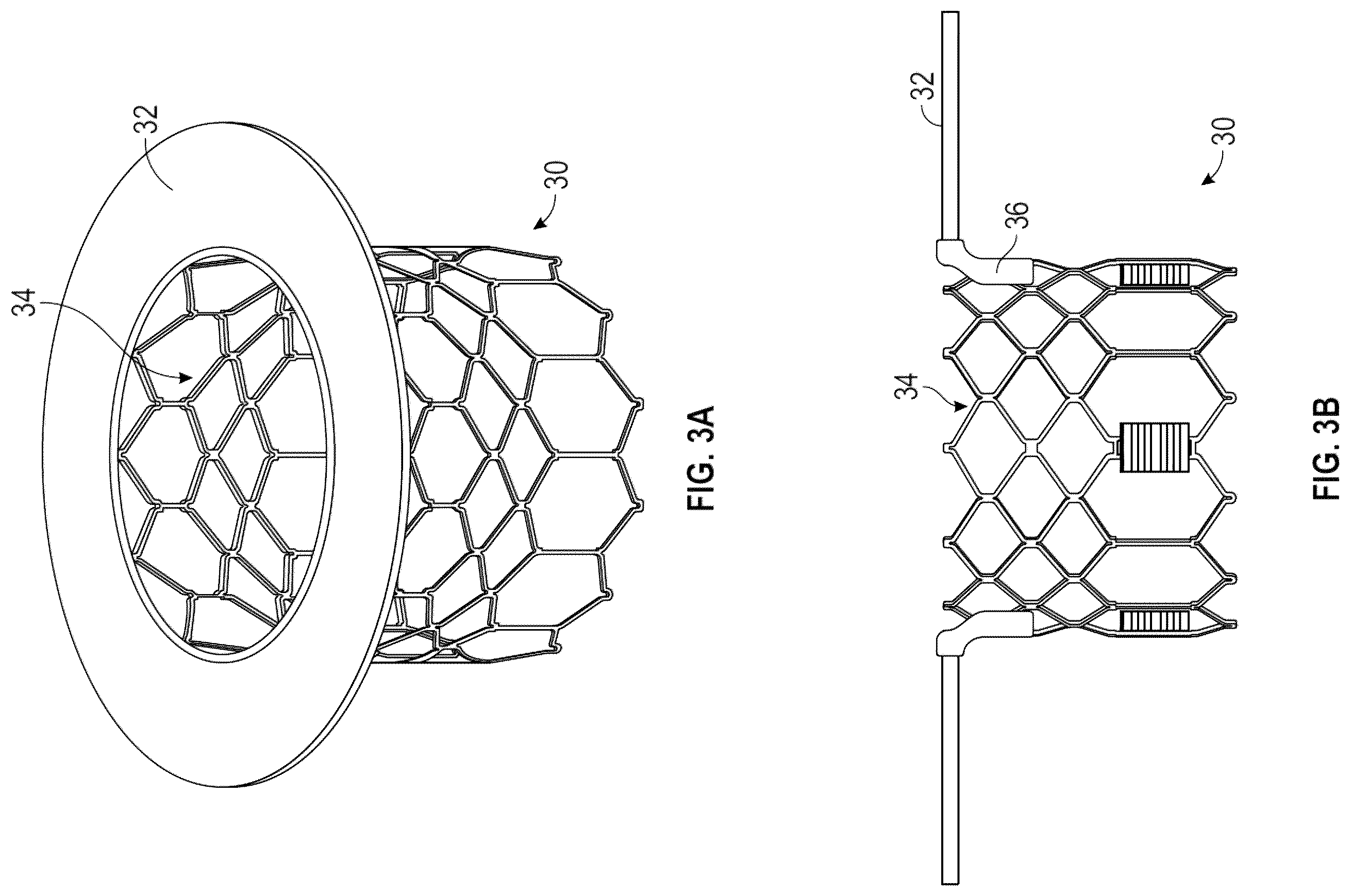 Patent US12472061 Figure 2 – Systems, devices, and methods for treating heart valves