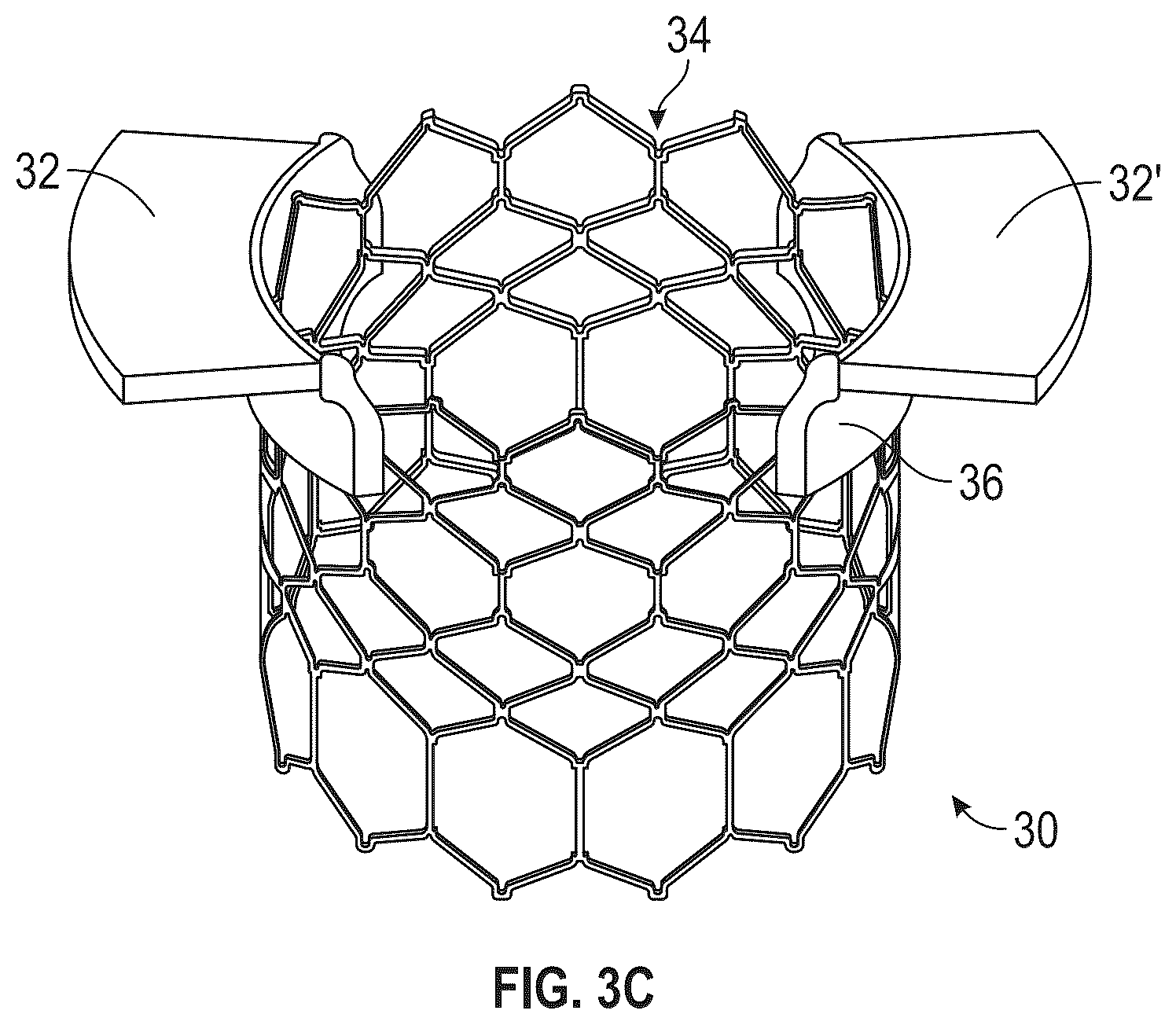Patent US12472061 Figure 3 – Systems, devices, and methods for treating heart valves