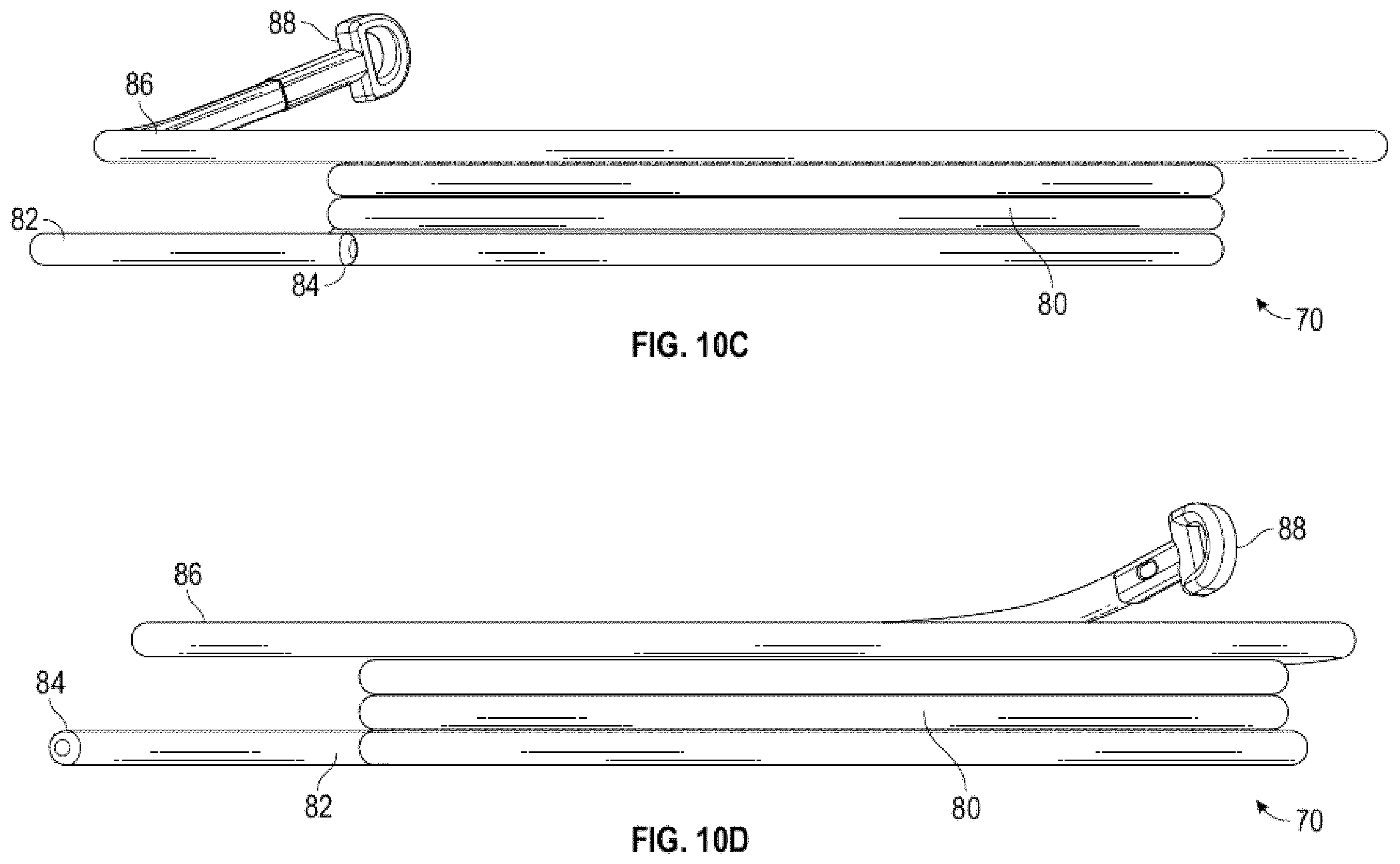 Patent US12472061 Figure 17 – Systems, devices, and methods for treating heart valves