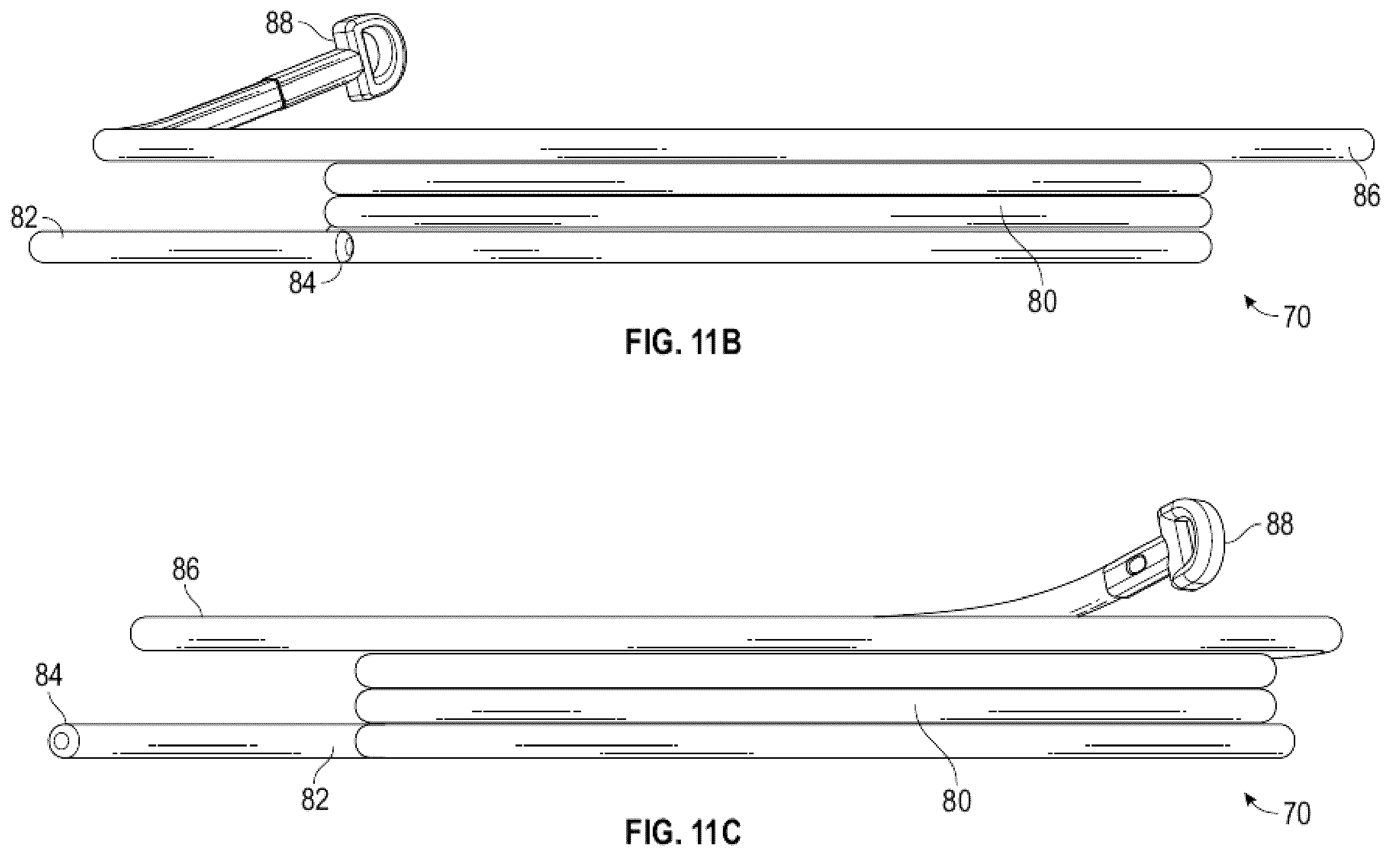 Patent US12472061 Figure 19 – Systems, devices, and methods for treating heart valves