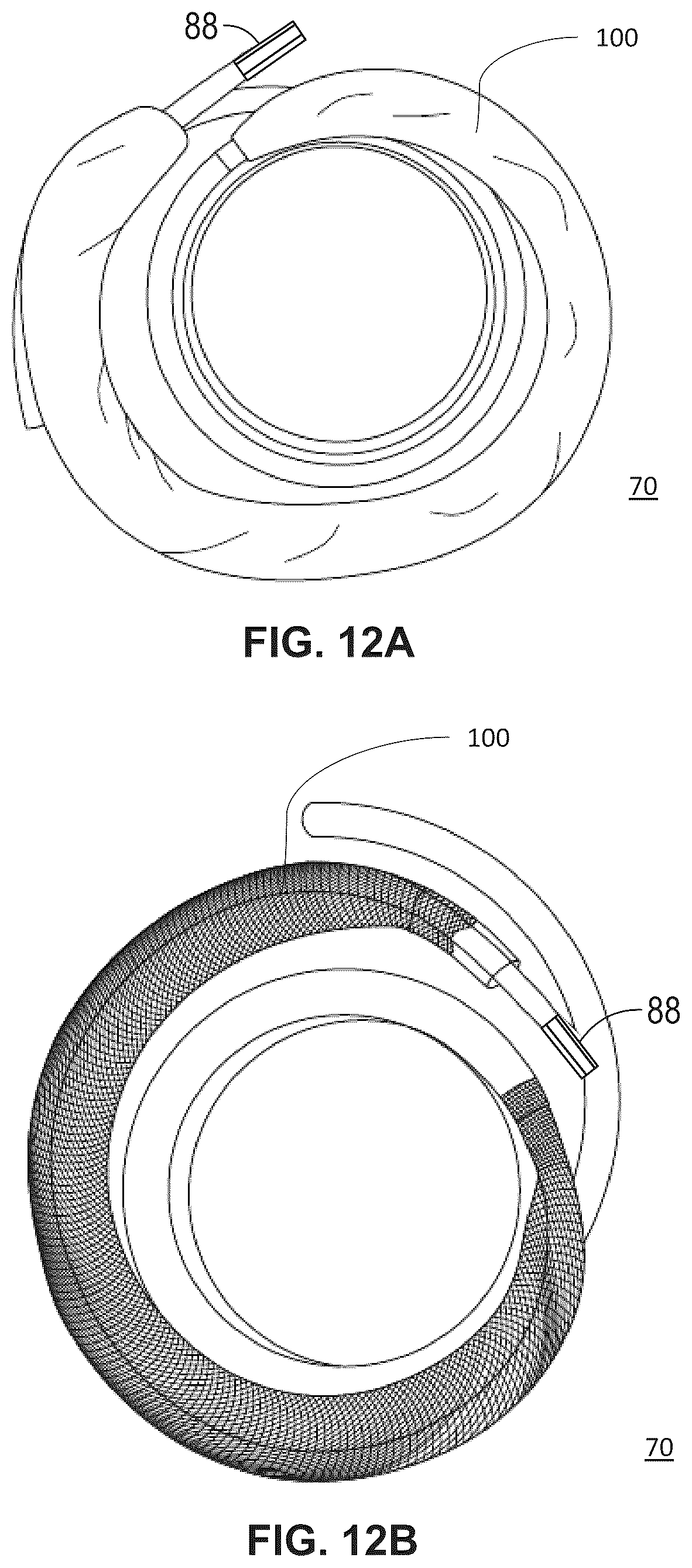 Patent US12472061 Figure 20 – Systems, devices, and methods for treating heart valves