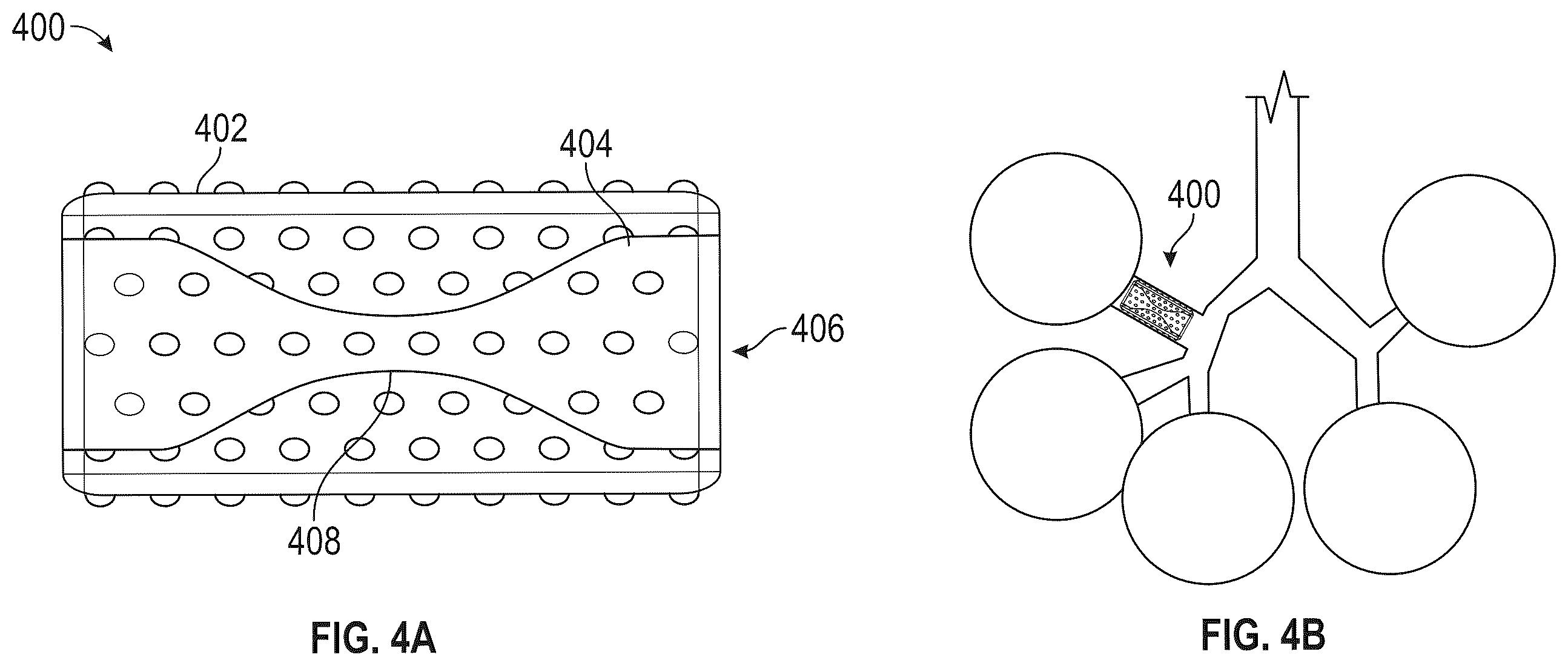 Patent US12472063 Figure 4 – Method and apparatus for treating hyperinflation and associated complications in lung regions