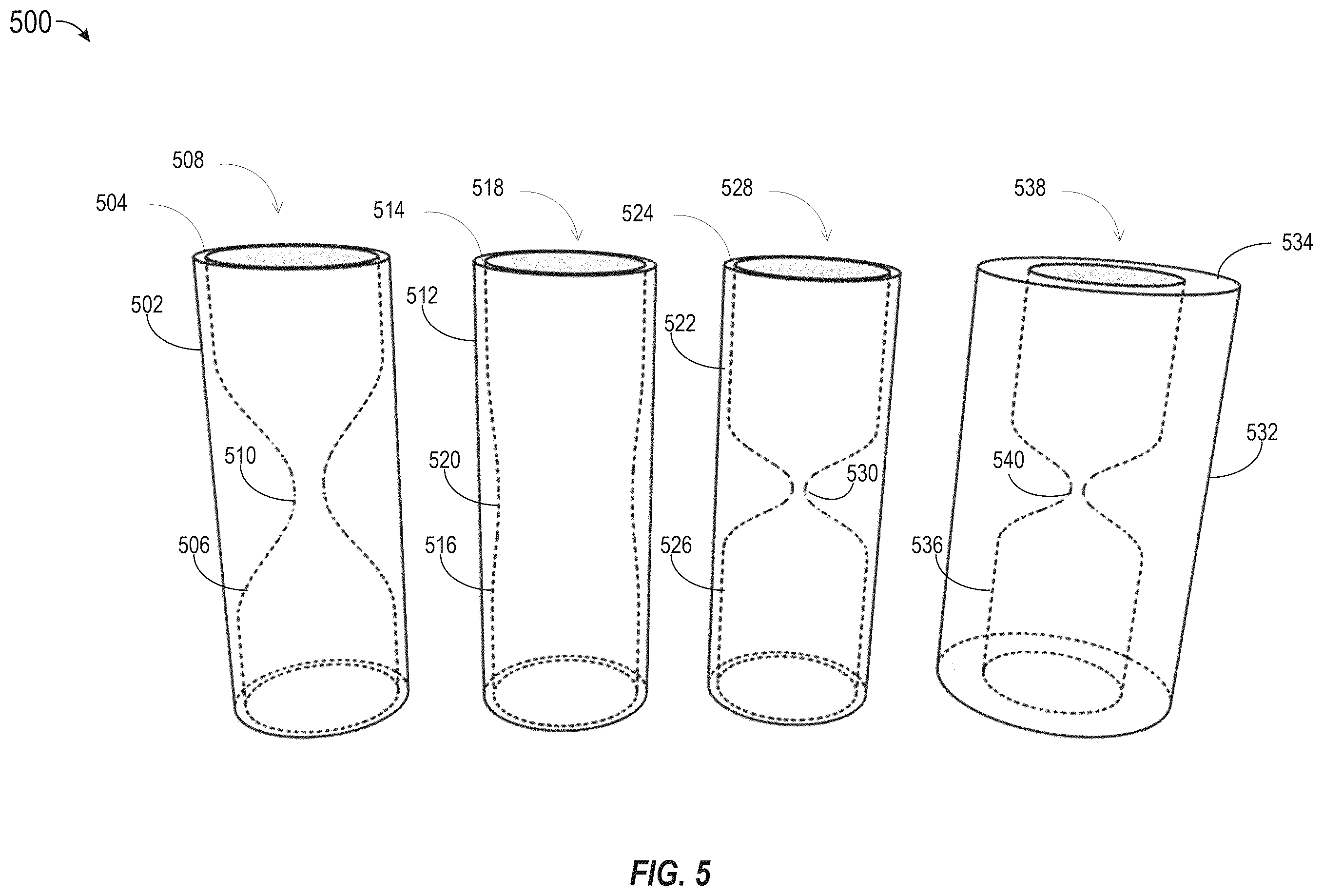 Patent US12472063 Figure 5 – Method and apparatus for treating hyperinflation and associated complications in lung regions