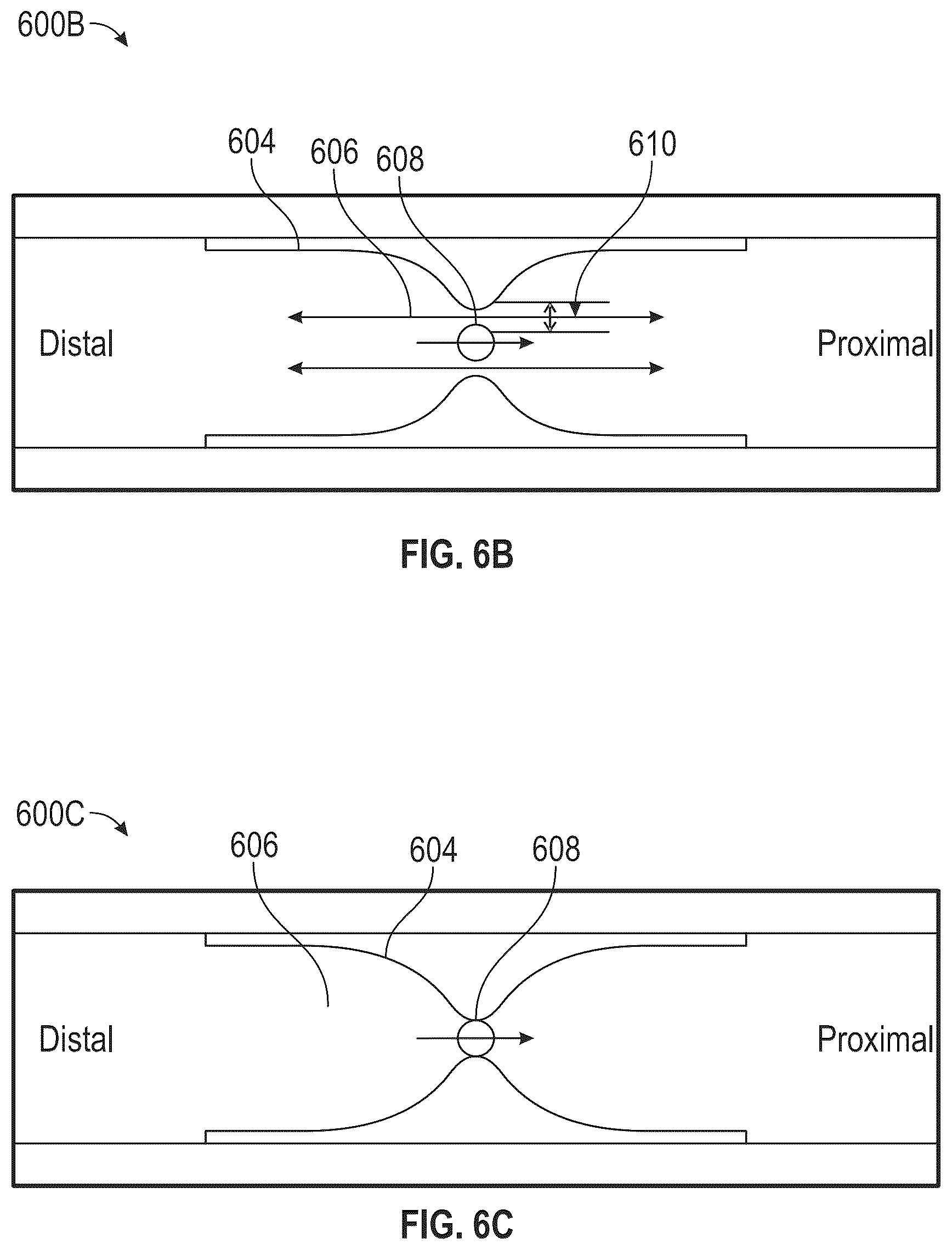 Patent US12472063 Figure 7 – Method and apparatus for treating hyperinflation and associated complications in lung regions