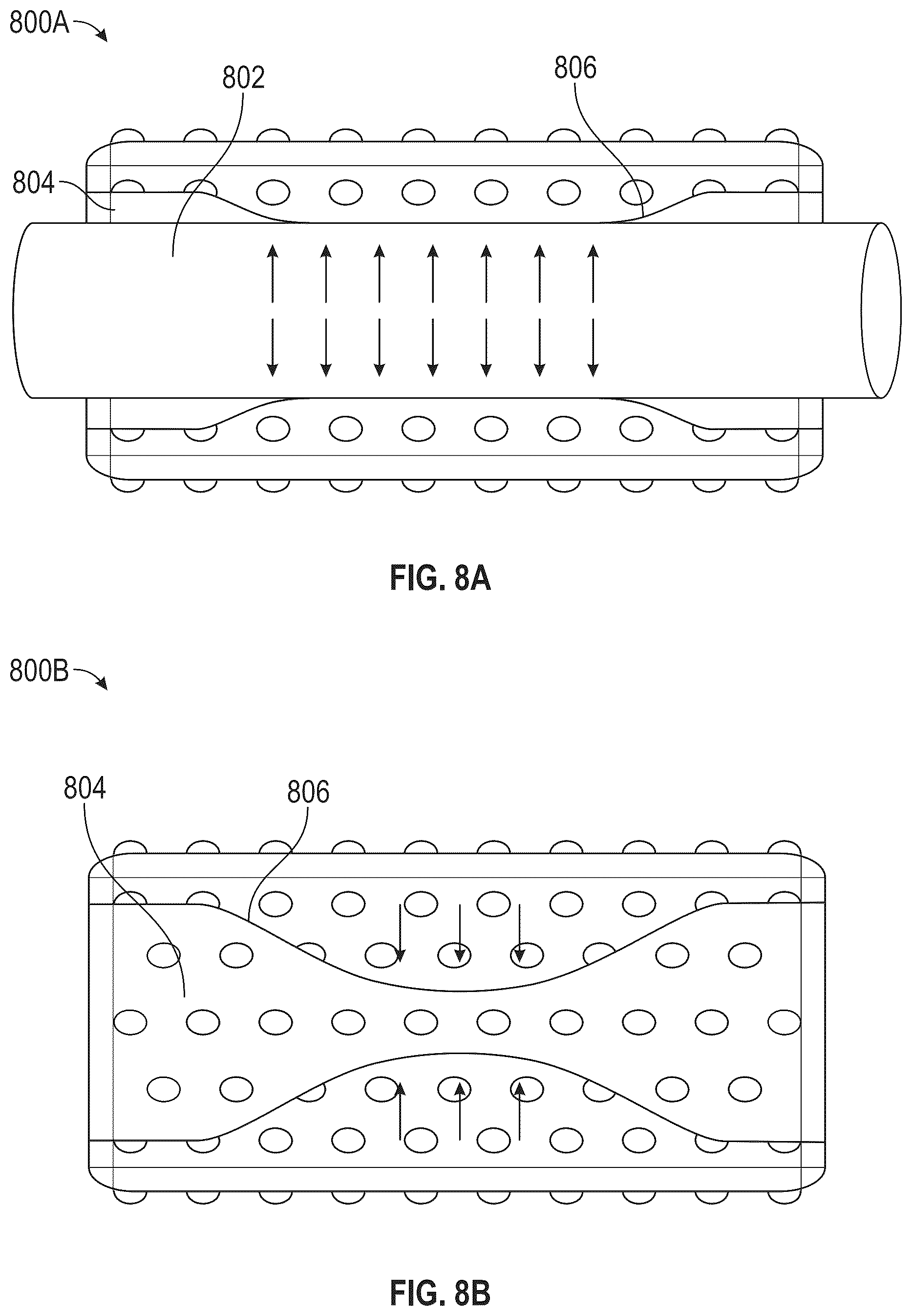Patent US12472063 Figure 9 – Method and apparatus for treating hyperinflation and associated complications in lung regions