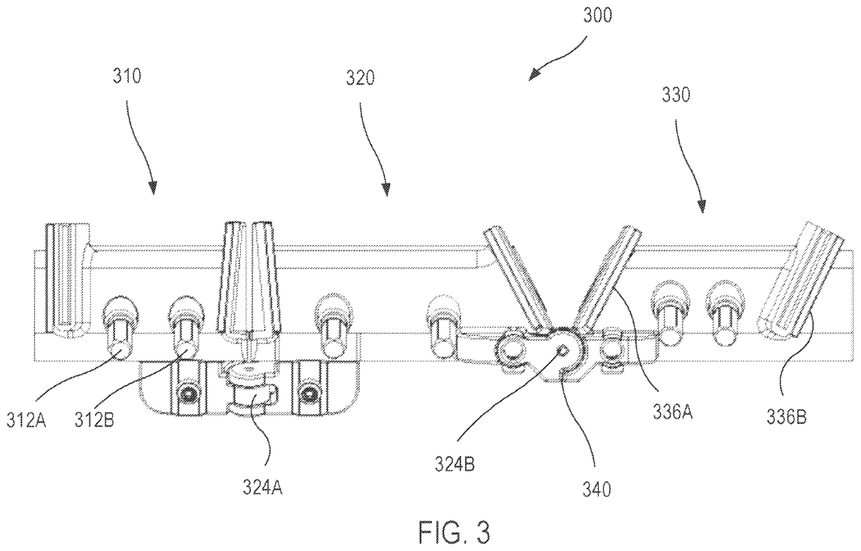 Patent US12472064 Figure 3 – Mandibular reconstruction systems and methods
