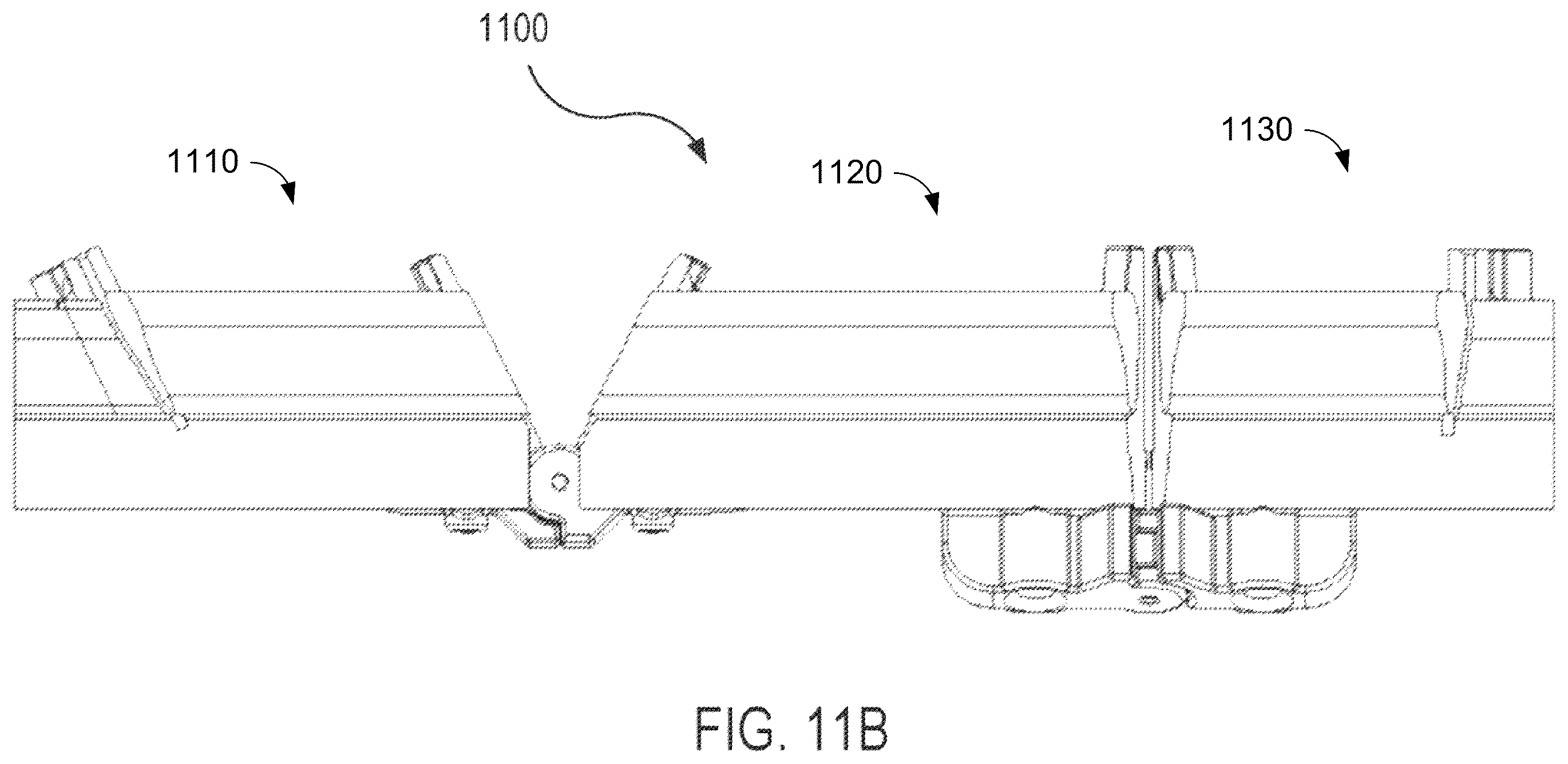 Patent US12472064 Figure 12 – Mandibular reconstruction systems and methods