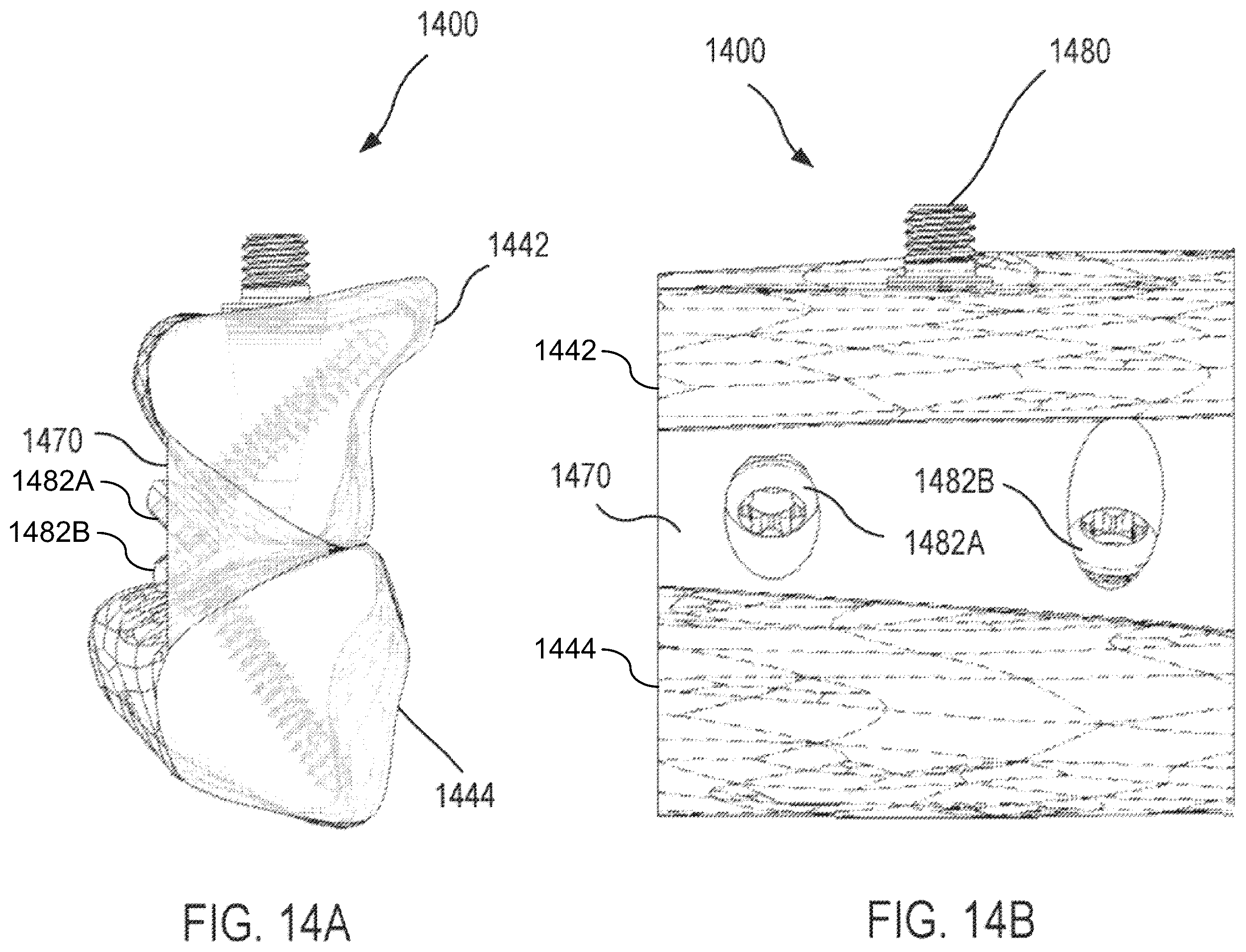 Patent US12472064 Figure 16 – Mandibular reconstruction systems and methods