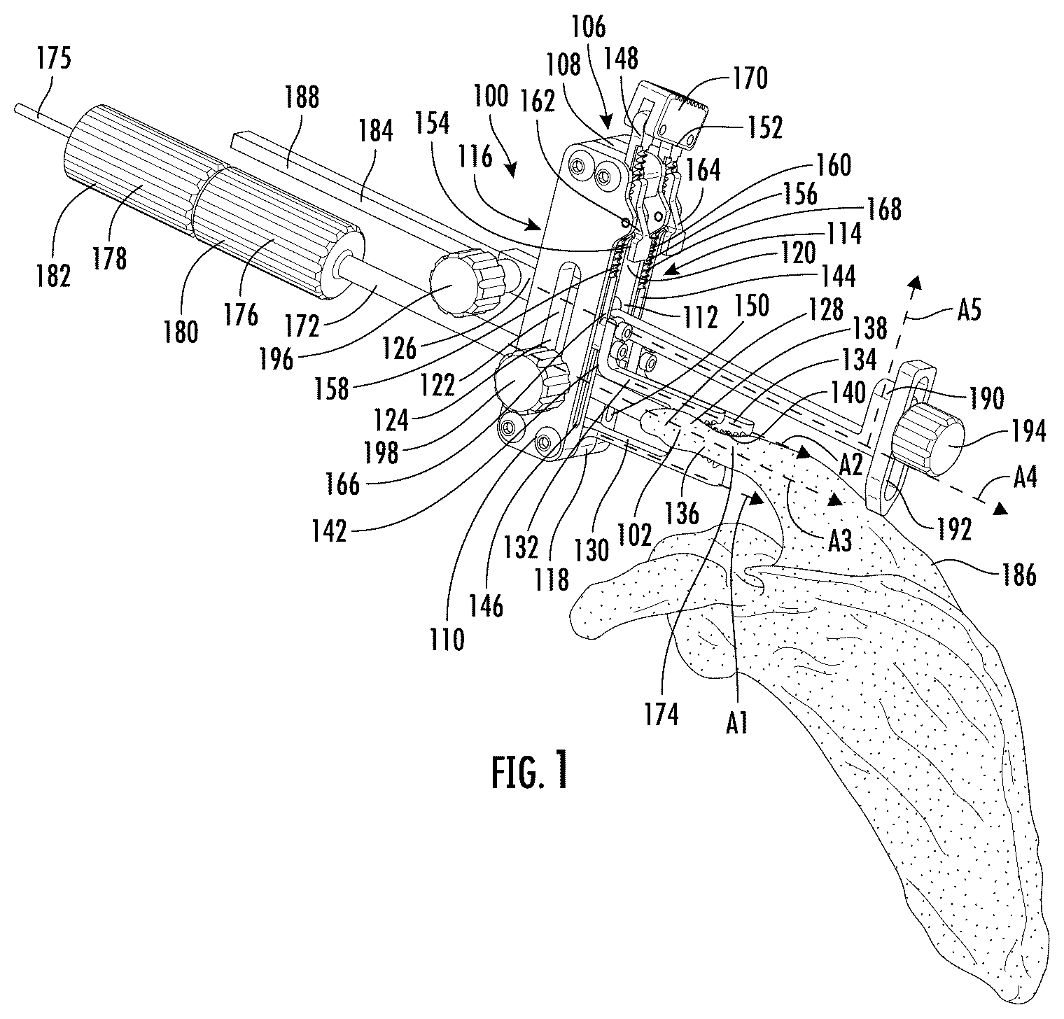 Patent US12472065 Figure 1 – Systems and methods of shoulder implant surgical guide