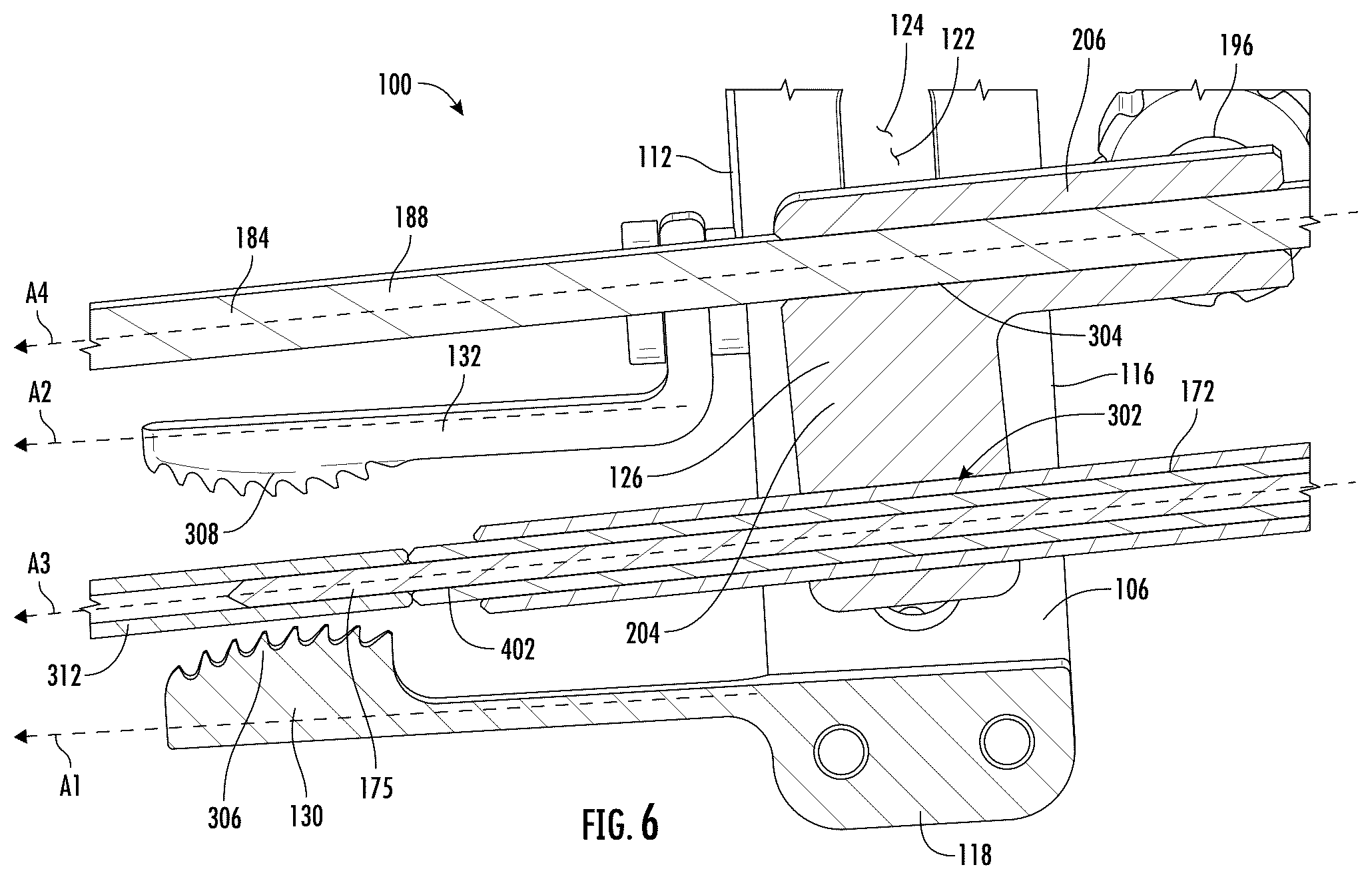 Patent US12472065 Figure 6 – Systems and methods of shoulder implant surgical guide