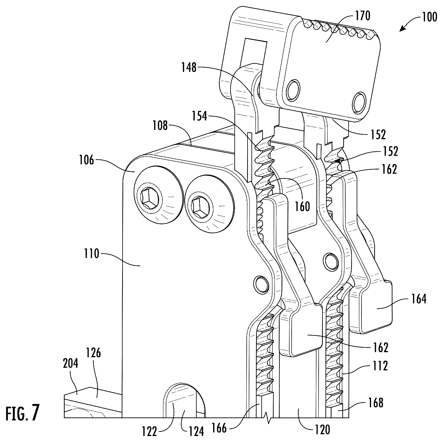 Patent US12472065 Figure 7 – Systems and methods of shoulder implant surgical guide