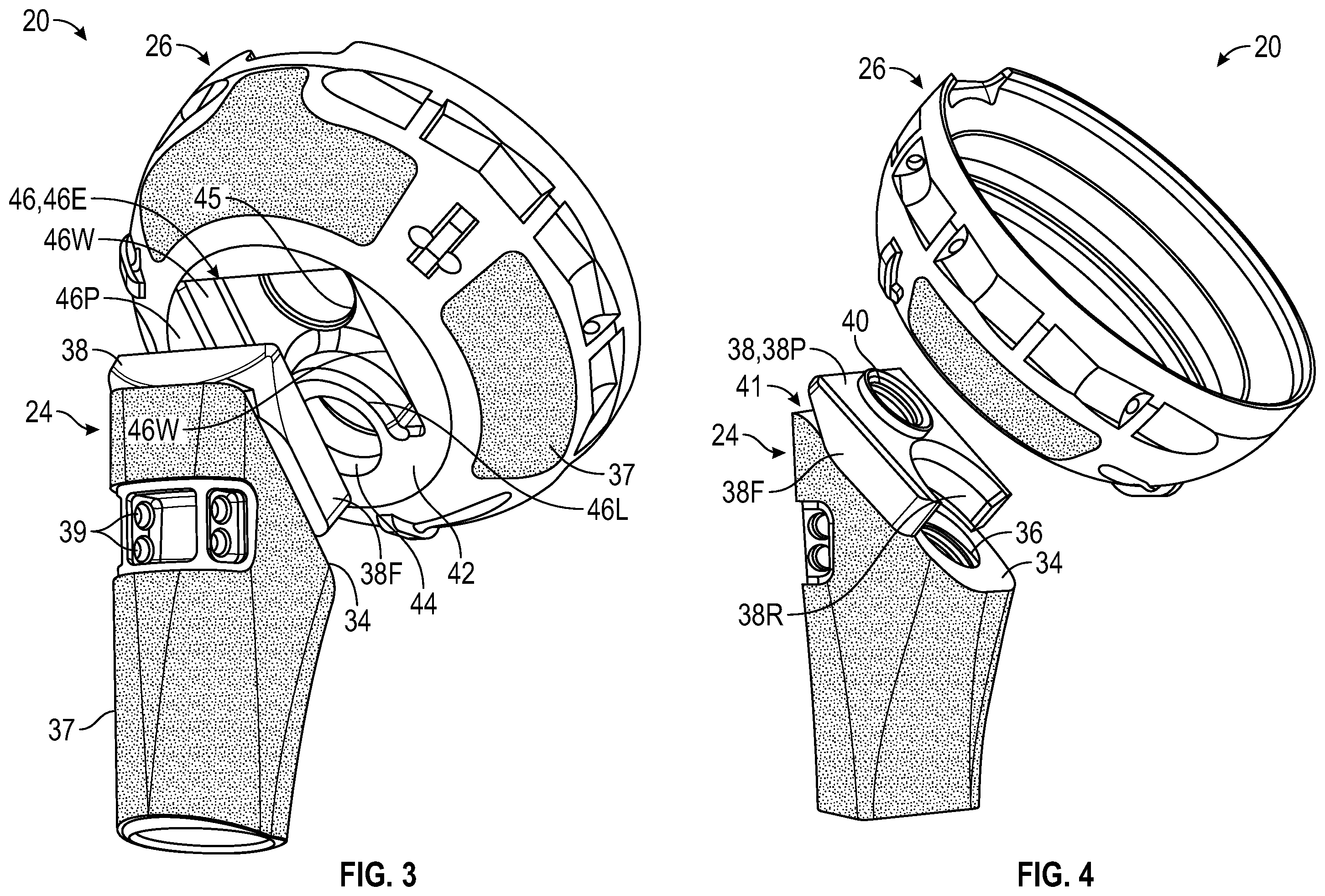 Patent US12472067 Figure 2 – Orthopaedic implant systems including fixation features and methods of repair