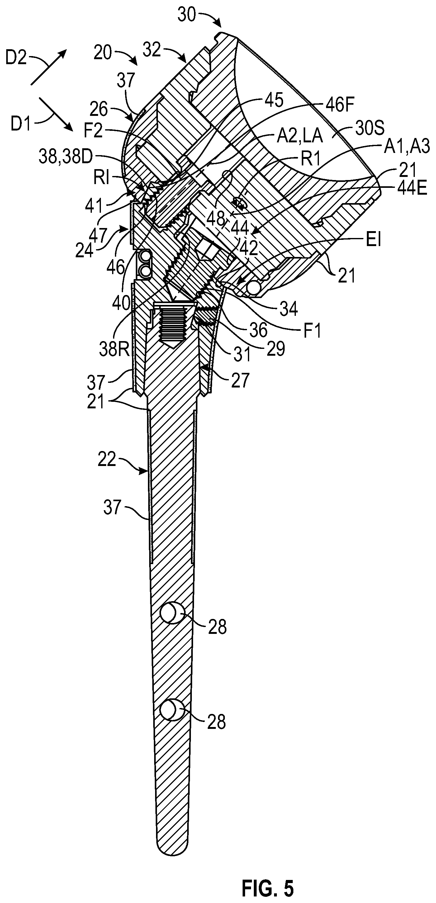 Patent US12472067 Figure 3 – Orthopaedic implant systems including fixation features and methods of repair