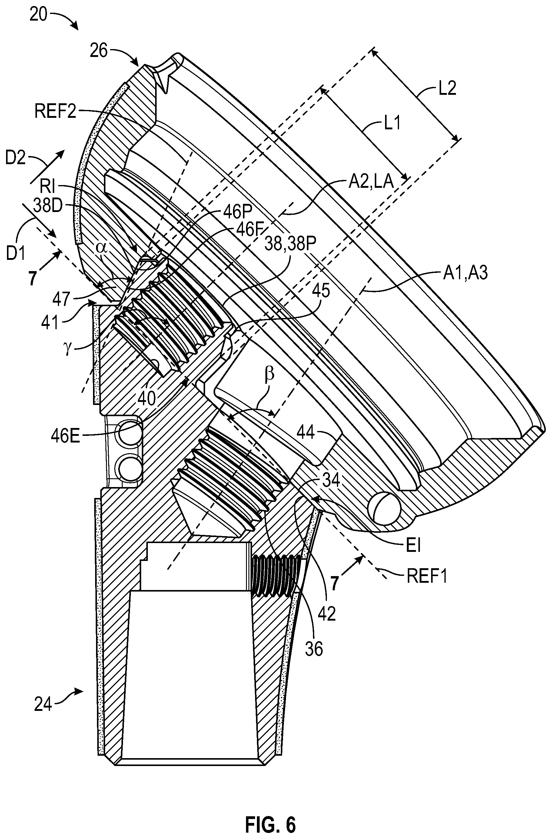 Patent US12472067 Figure 4 – Orthopaedic implant systems including fixation features and methods of repair