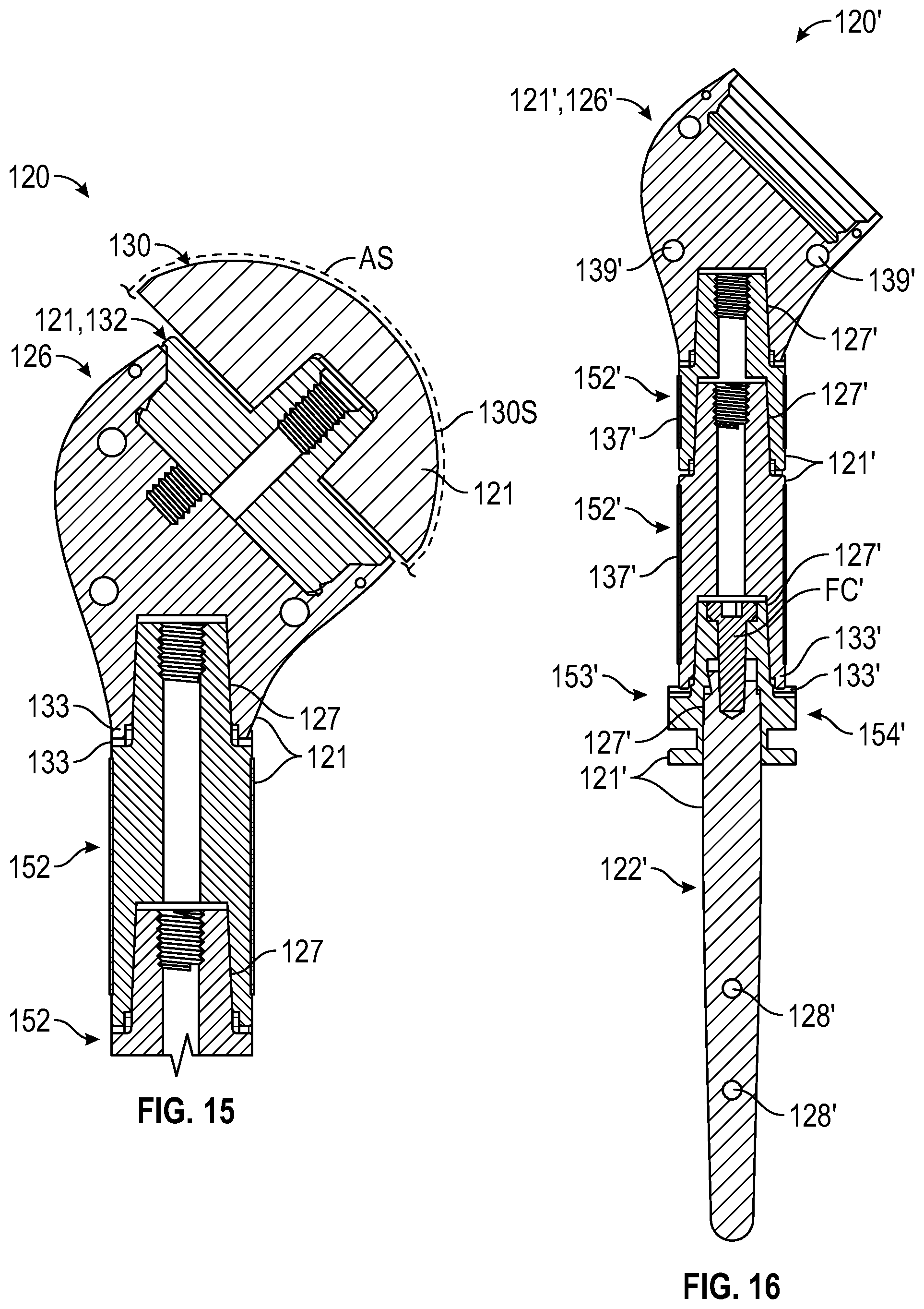 Patent US12472067 Figure 10 – Orthopaedic implant systems including fixation features and methods of repair