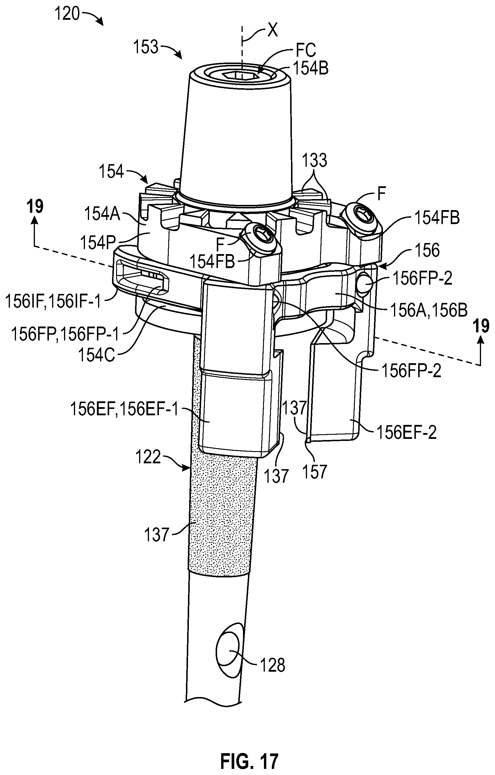 Patent US12472067 Figure 11 – Orthopaedic implant systems including fixation features and methods of repair