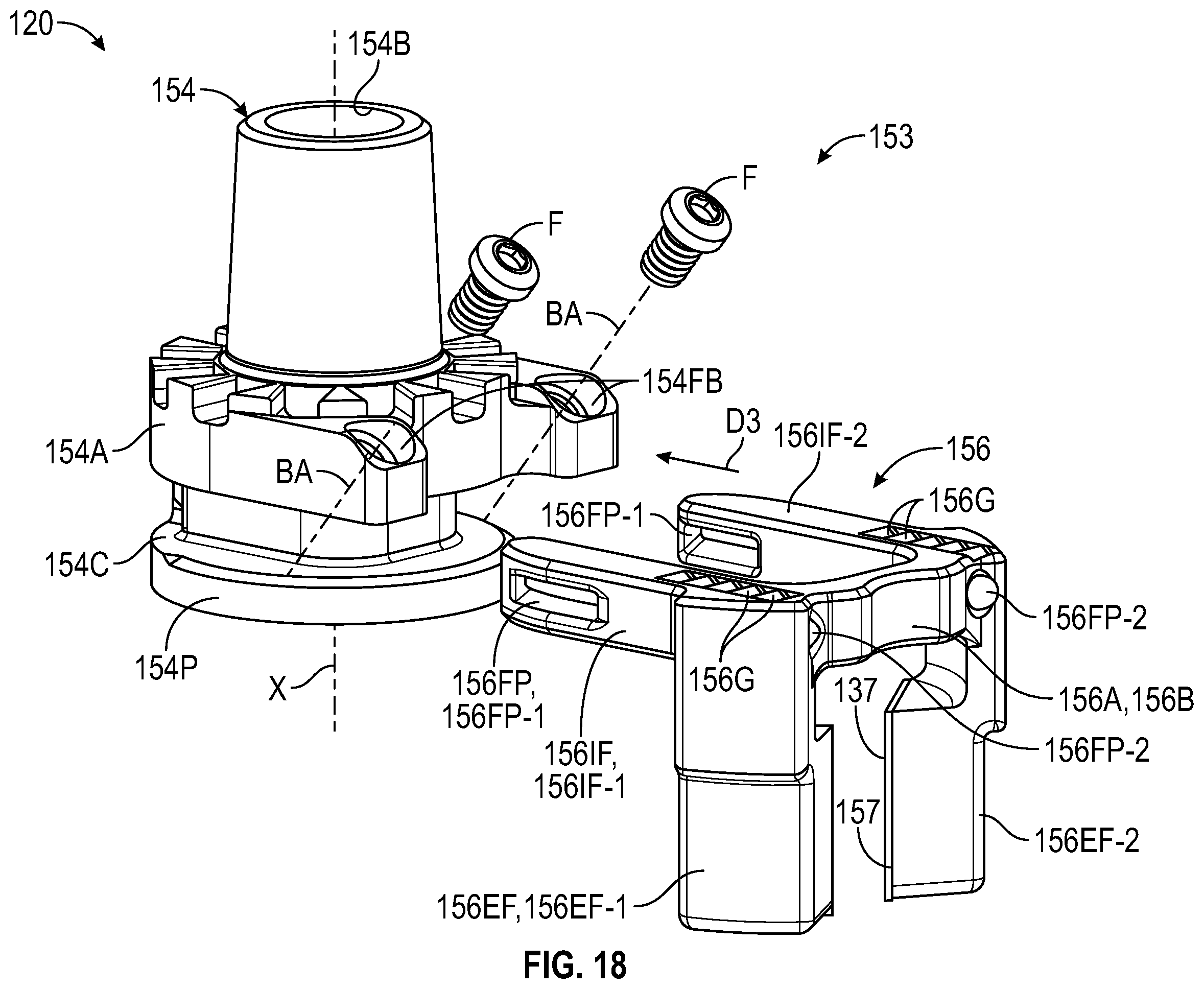 Patent US12472067 Figure 12 – Orthopaedic implant systems including fixation features and methods of repair