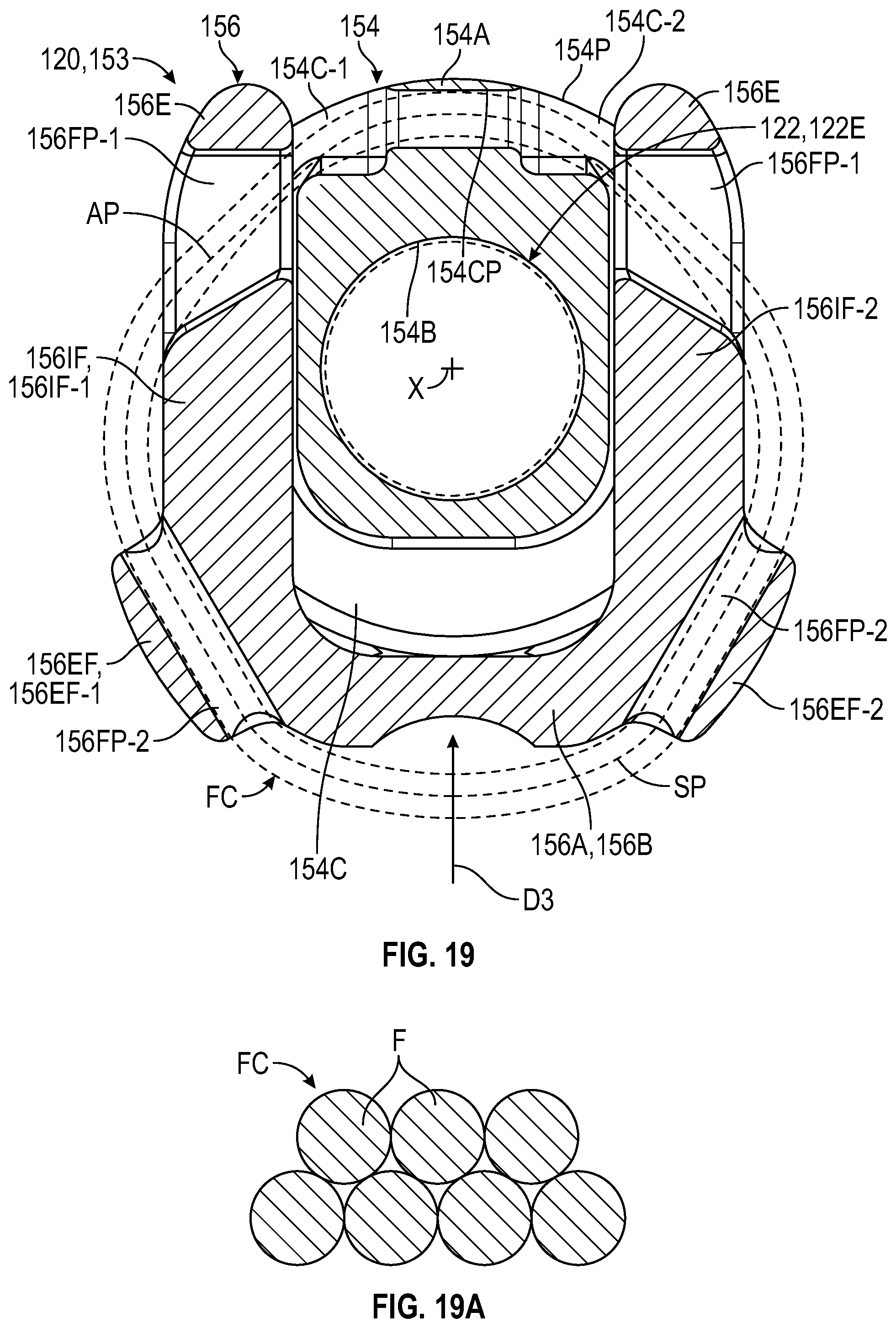 Patent US12472067 Figure 13 – Orthopaedic implant systems including fixation features and methods of repair