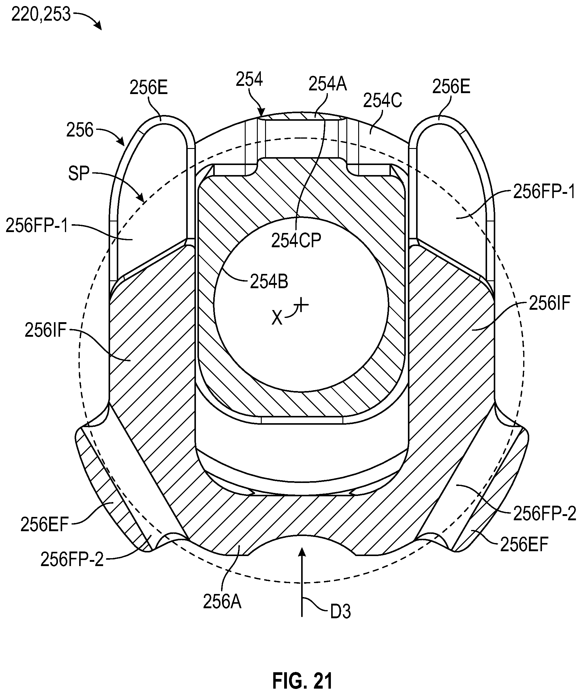 Patent US12472067 Figure 15 – Orthopaedic implant systems including fixation features and methods of repair