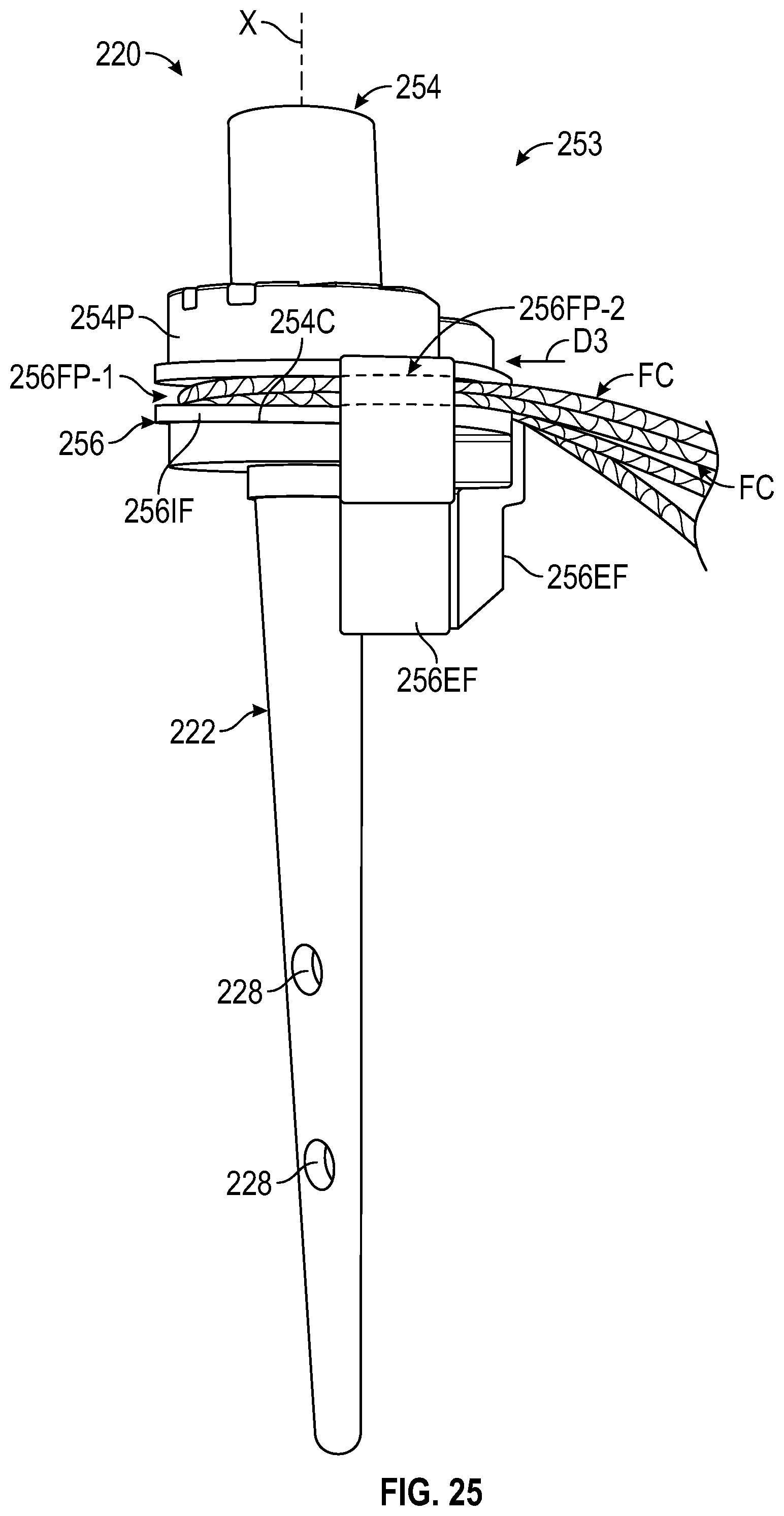 Patent US12472067 Figure 18 – Orthopaedic implant systems including fixation features and methods of repair