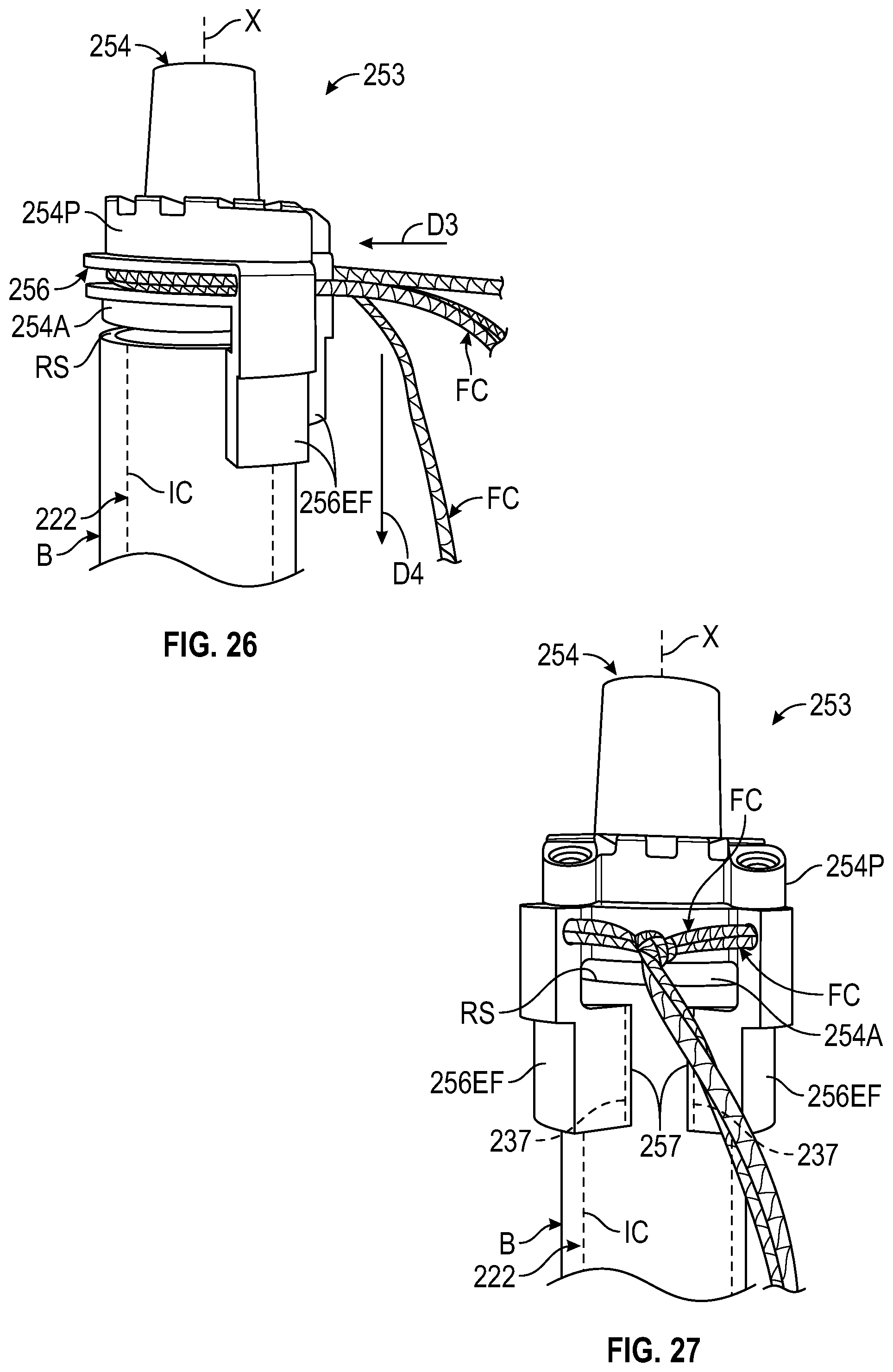 Patent US12472067 Figure 19 – Orthopaedic implant systems including fixation features and methods of repair