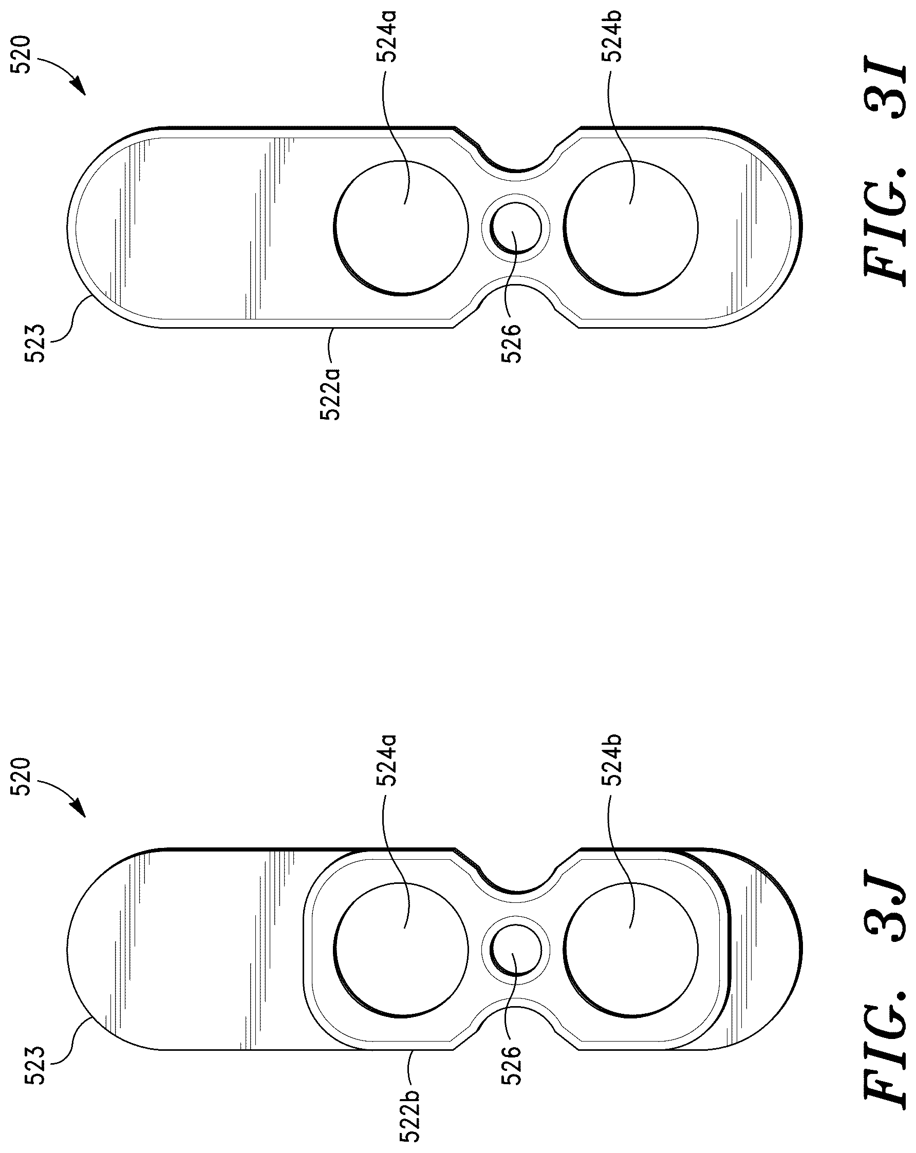 Patent US12472069 Figure 12 – Methods for sacroiliac joint stabilization