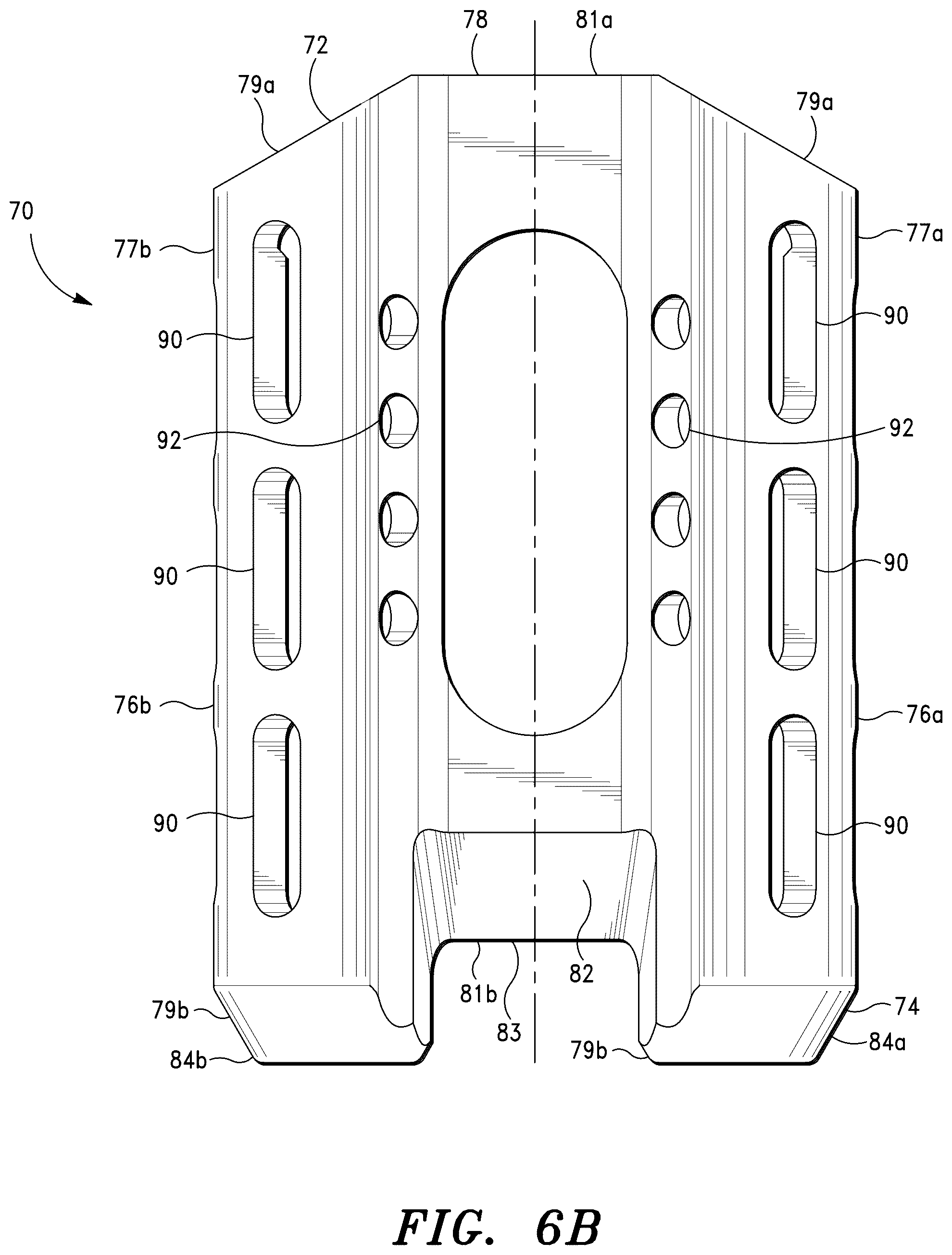 Patent US12472069 Figure 20 – Methods for sacroiliac joint stabilization