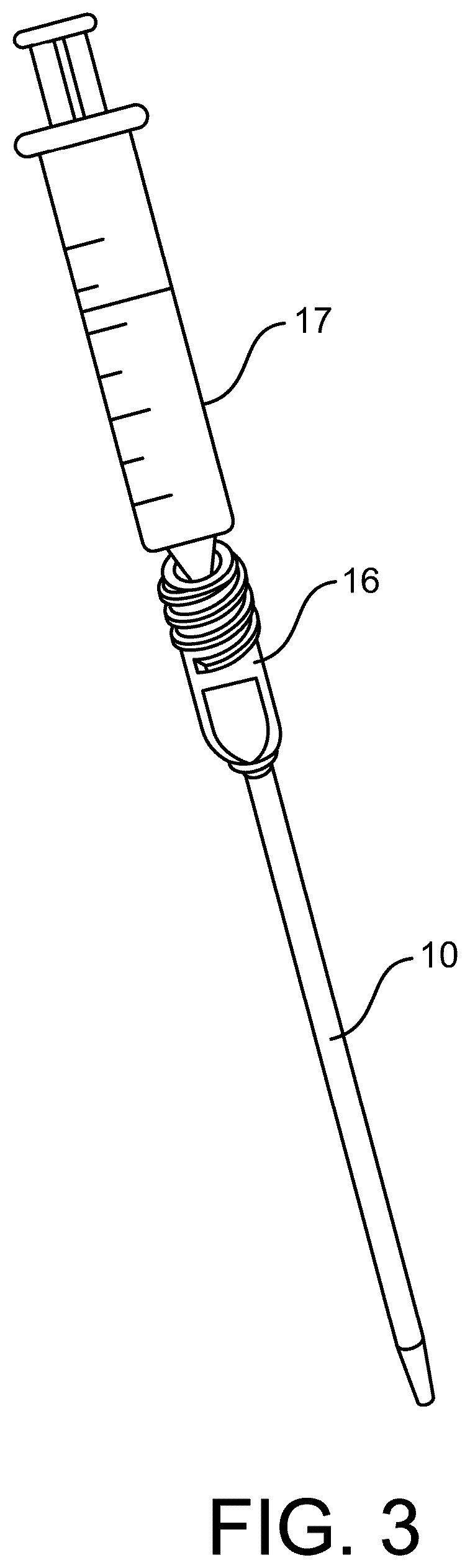 Patent US12472070 Figure 3 – Method and apparatus for joint stabilization
