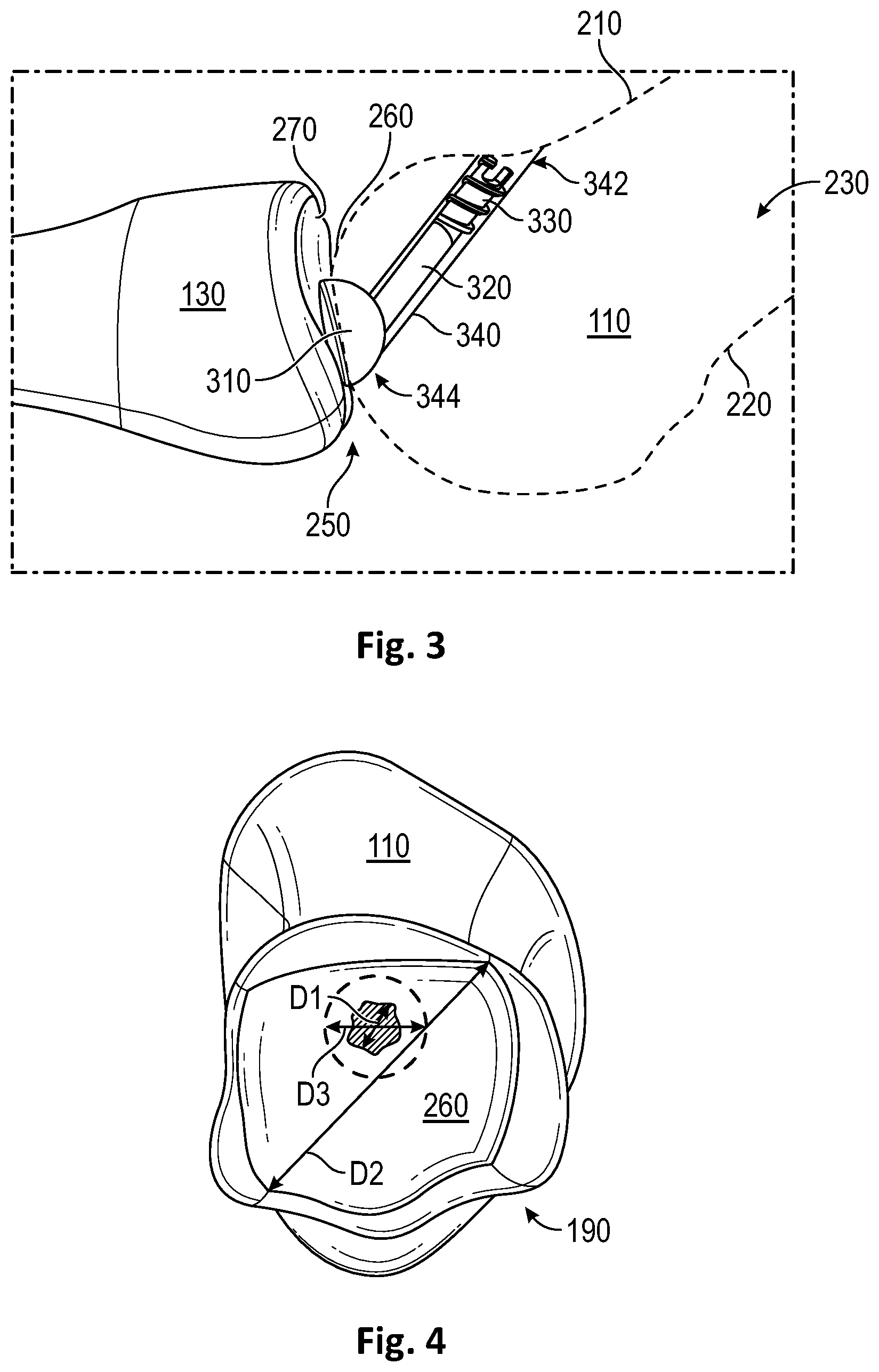 Patent US12472072 Figure 2 – Joint implant apparatus, system, and method