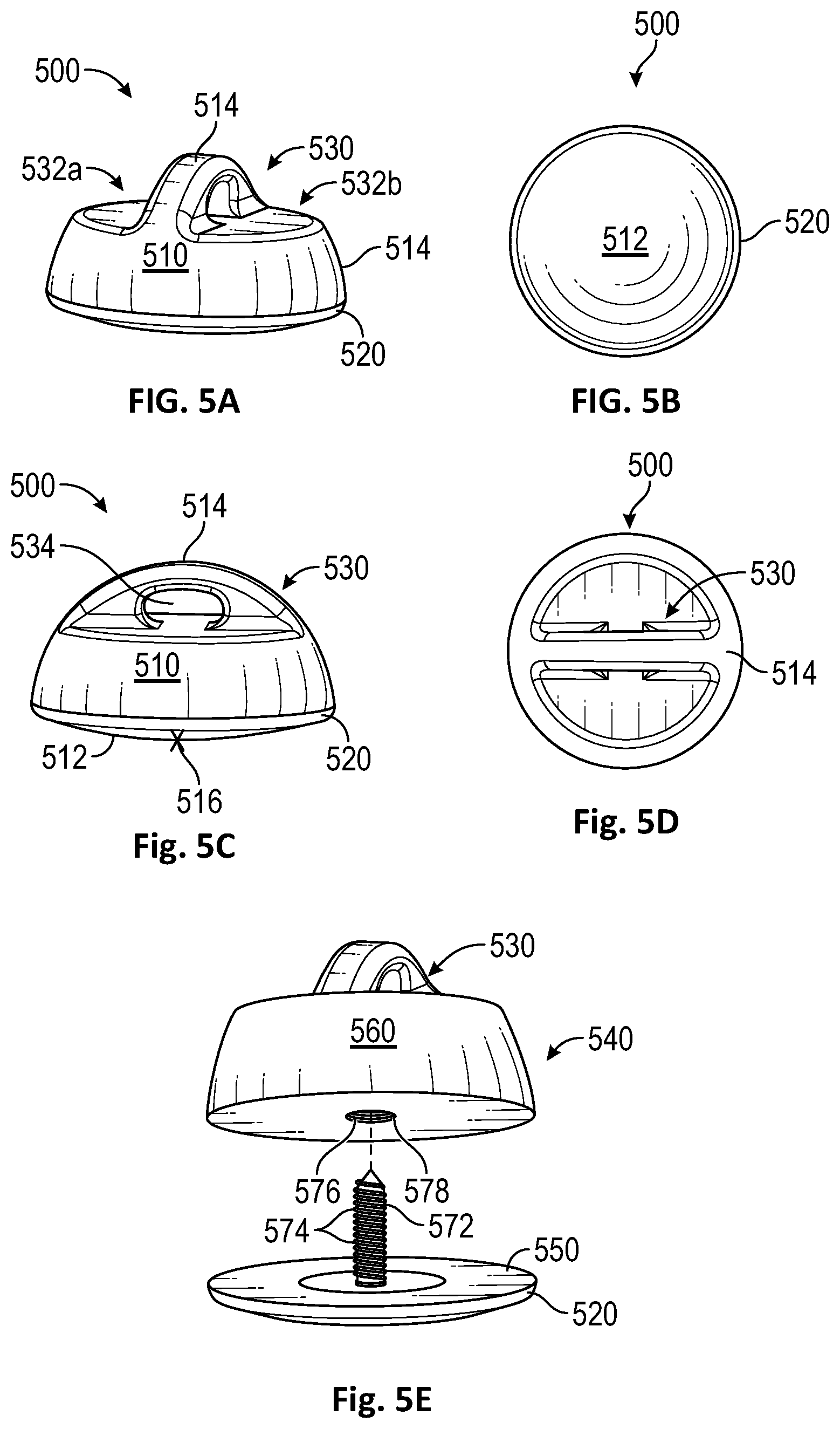 Patent US12472072 Figure 3 – Joint implant apparatus, system, and method