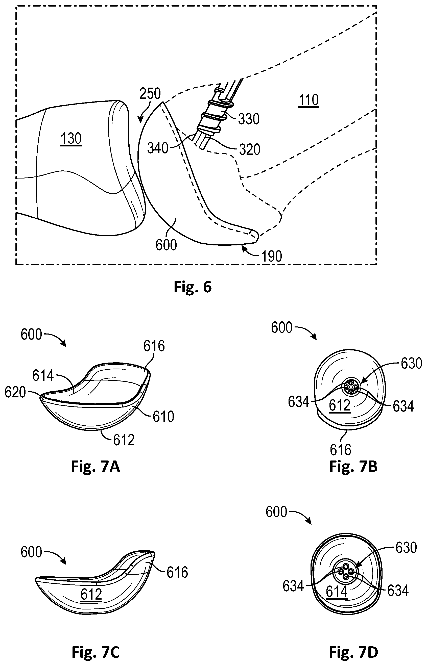 Patent US12472072 Figure 4 – Joint implant apparatus, system, and method