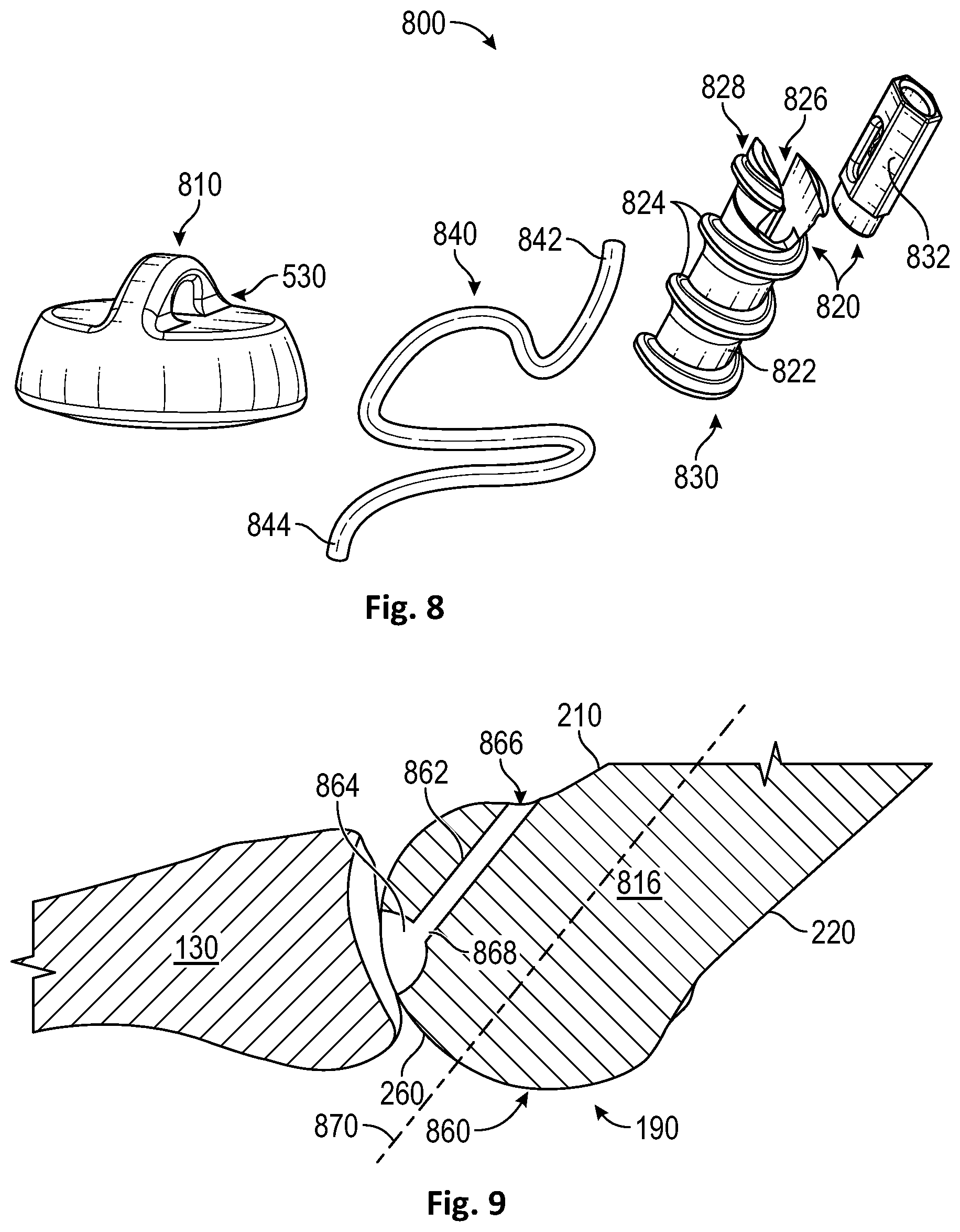 Patent US12472072 Figure 5 – Joint implant apparatus, system, and method