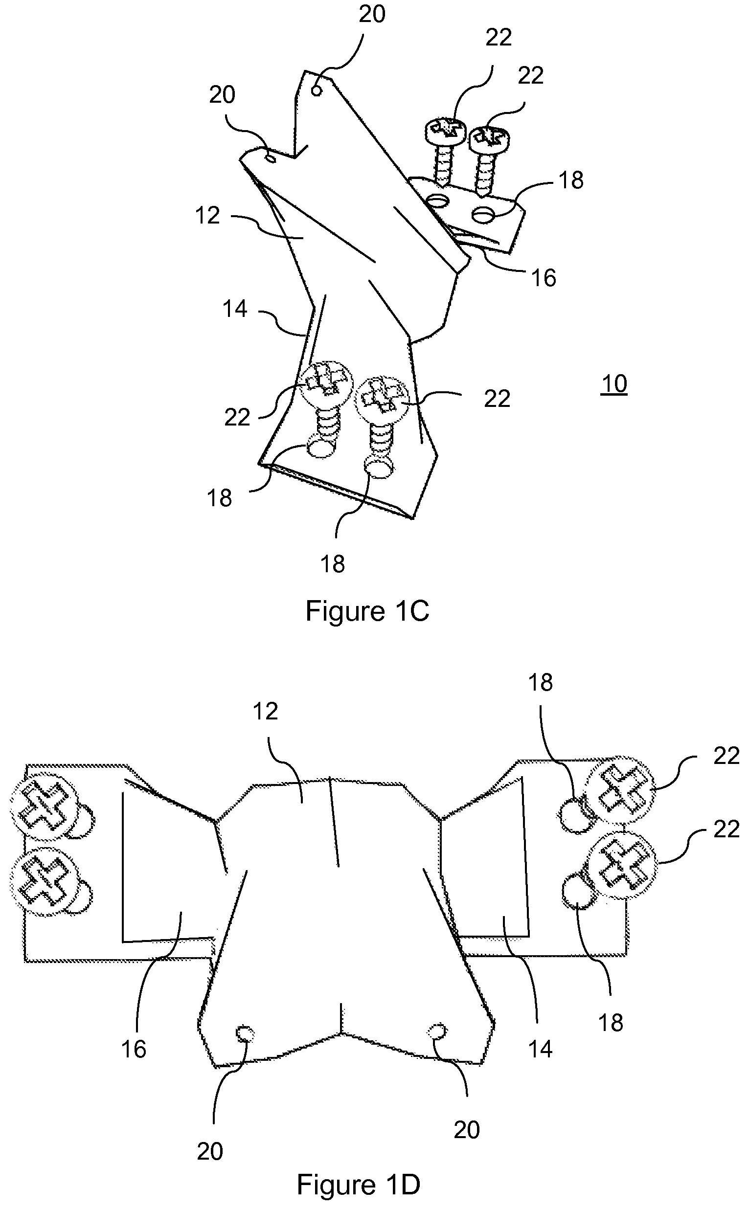 Patent US12472073 Figure 2 – Spinal lamina implant