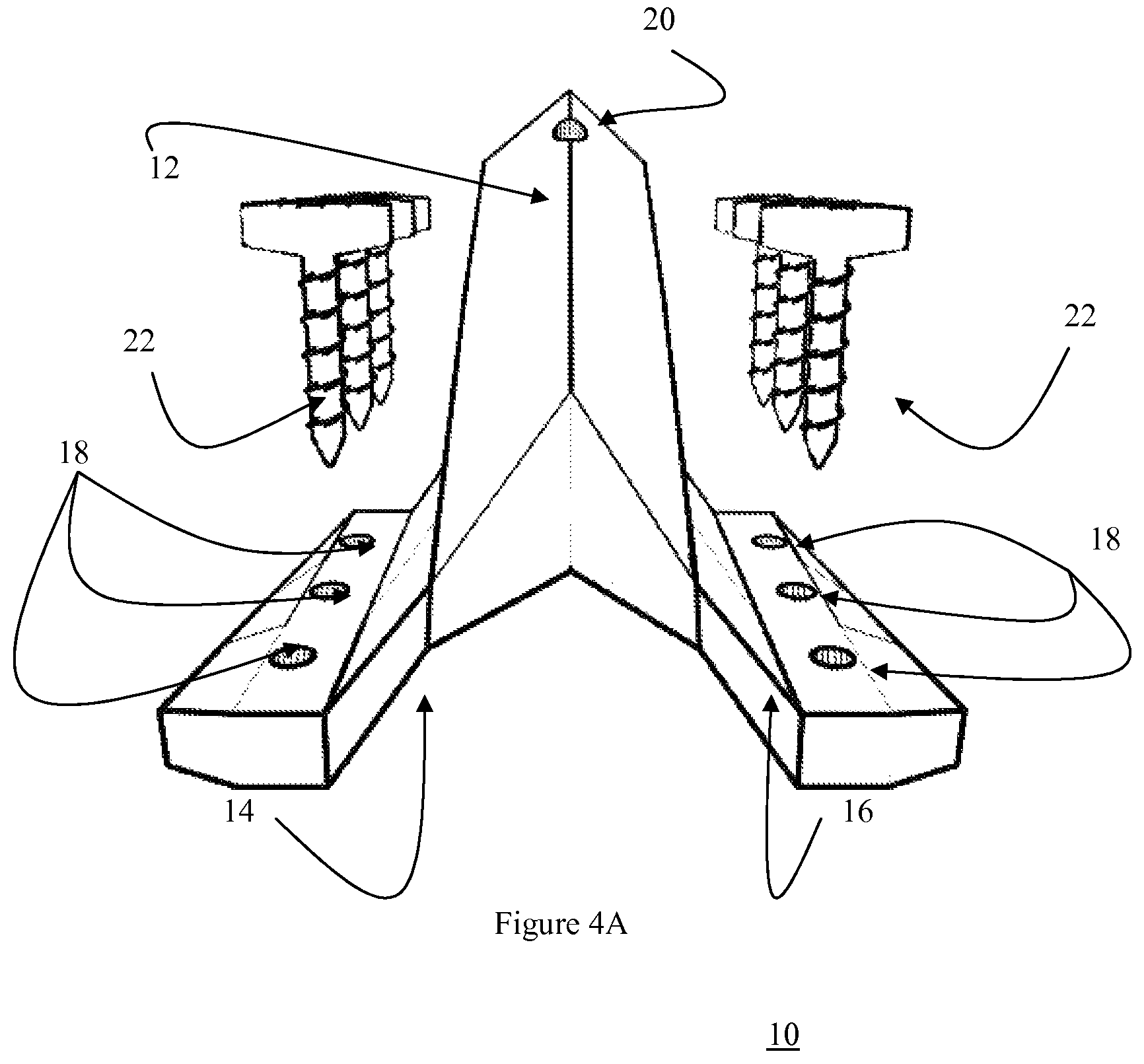 Patent US12472073 Figure 11 – Spinal lamina implant