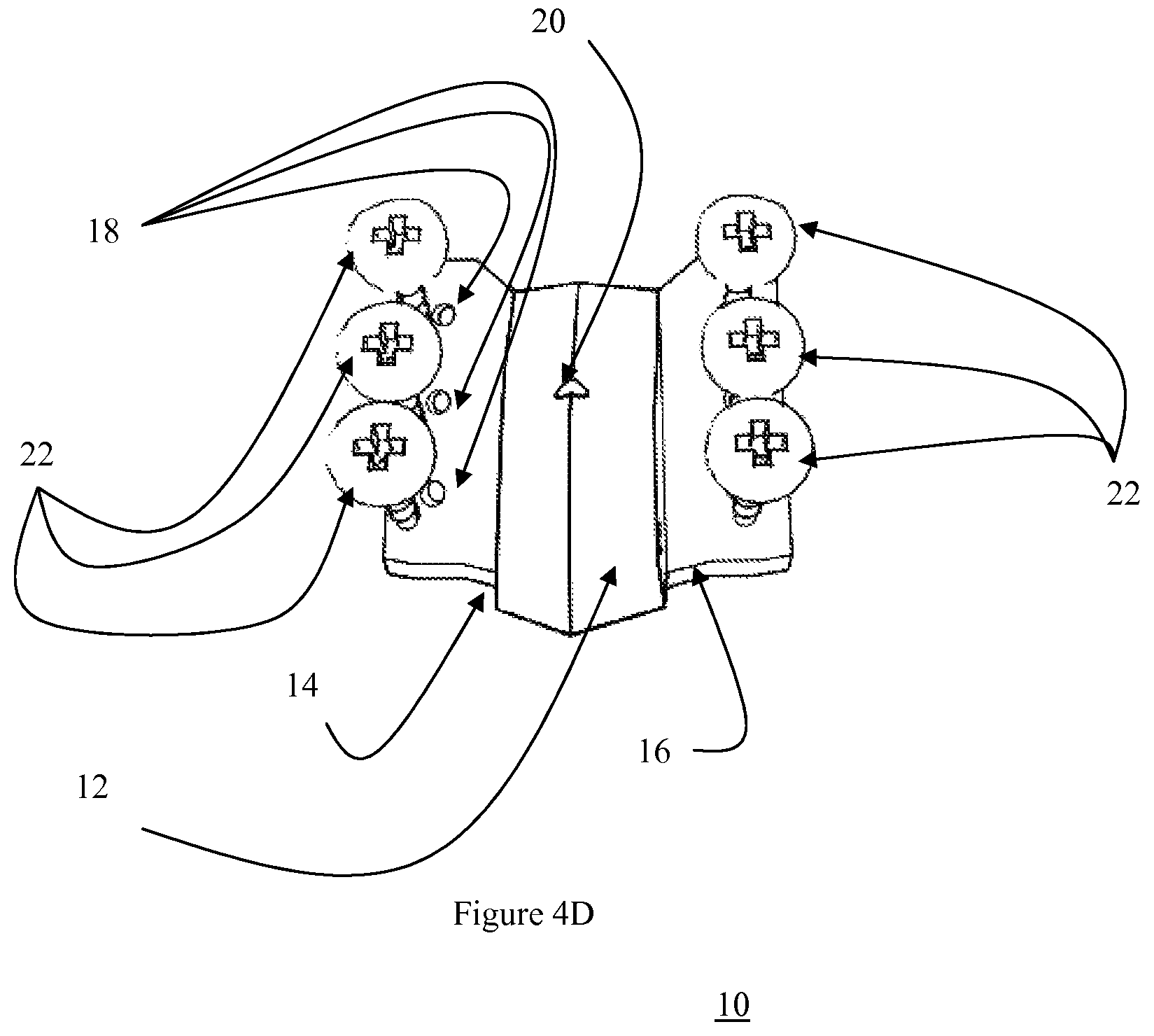 Patent US12472073 Figure 14 – Spinal lamina implant