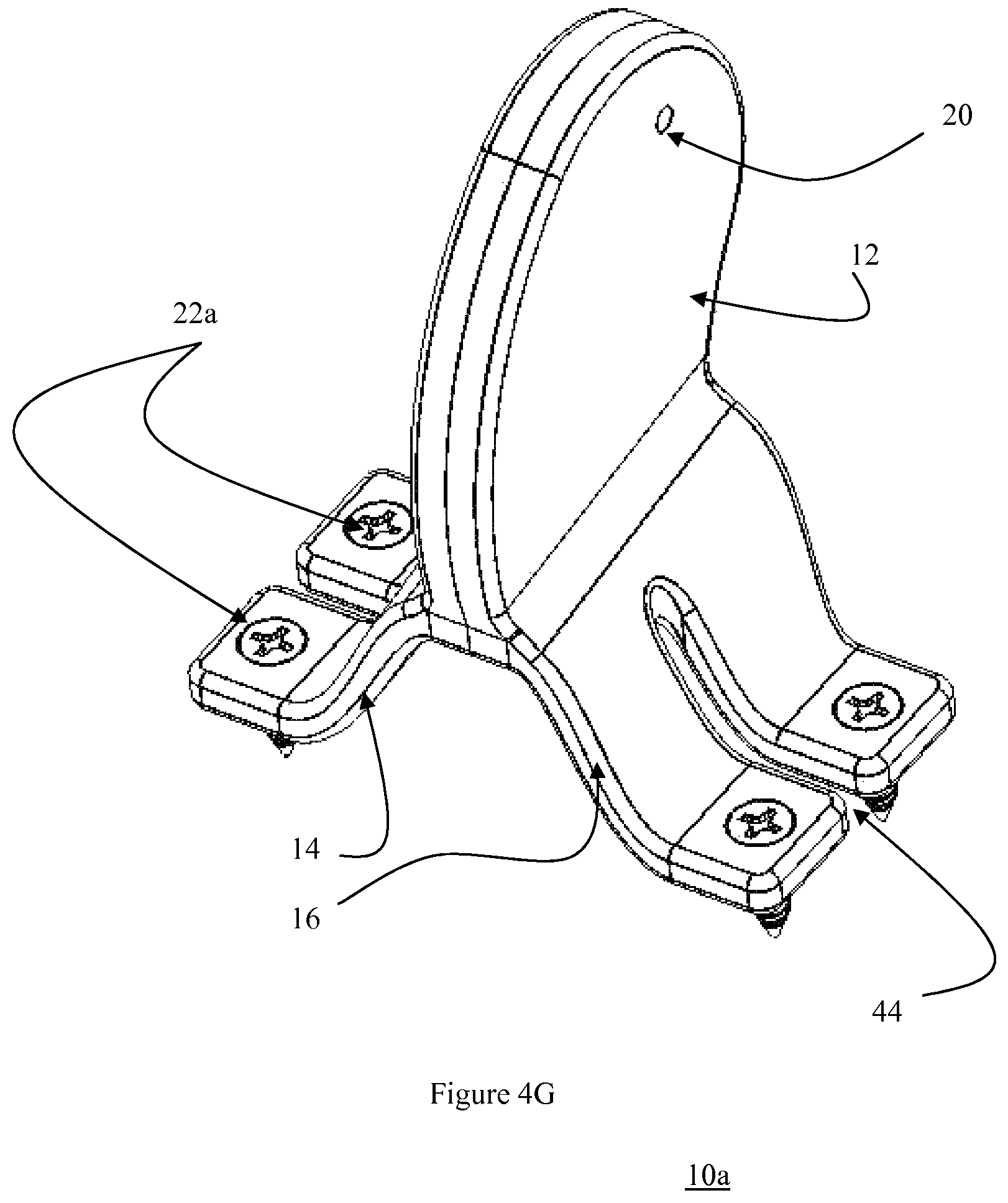 Patent US12472073 Figure 17 – Spinal lamina implant